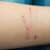 Cat & Dog Scratches: Essential Home First Aid & When to See Your Vet