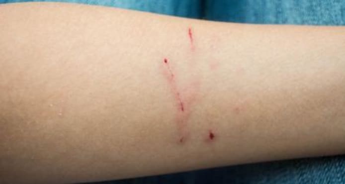 Cat & Dog Scratches: Essential Home First Aid & When to See Your Vet