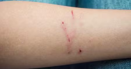 Cat & Dog Scratches: Essential Home First Aid & When to See Your Vet