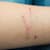 Cat & Dog Scratches: Essential Home First Aid & When to See Your Vet