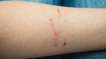 Cat & Dog Scratches: Essential Home First Aid & When to See Your Vet