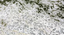 Why Your Fish Pond Foams: Causes, Solutions for a Clear Pond