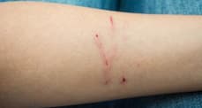 Cat & Dog Scratches: Essential Home First Aid & When to See Your Vet