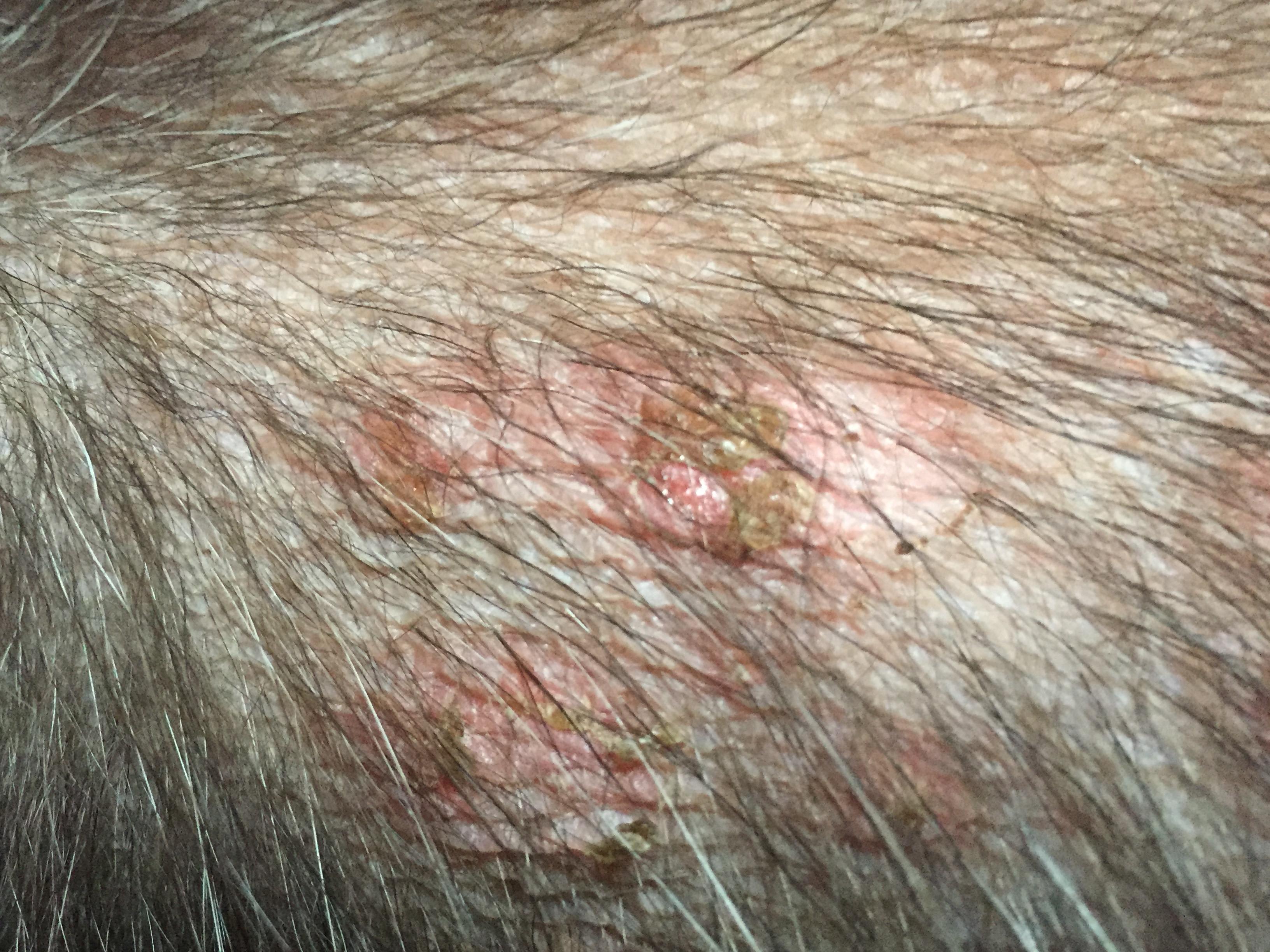 Why Does My Dog Have a Rash, Red Bumps & Dry Skin on His Belly? | Petco