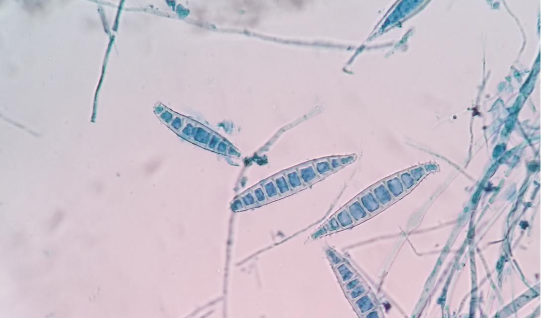 Ringworm in Dogs
