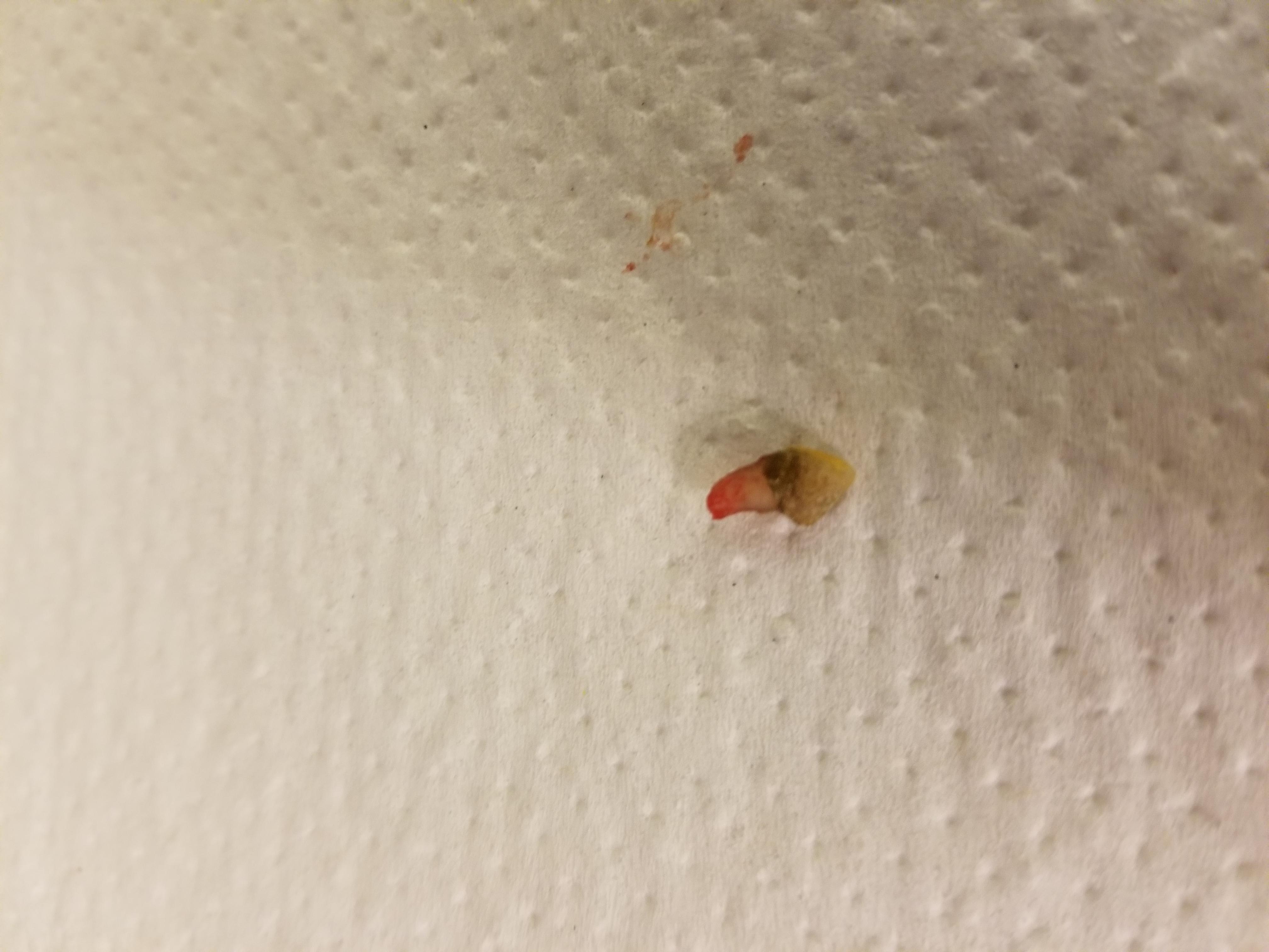 My Dog's Tooth Fell Out from Decay: Risks & Antibiotics | Petco