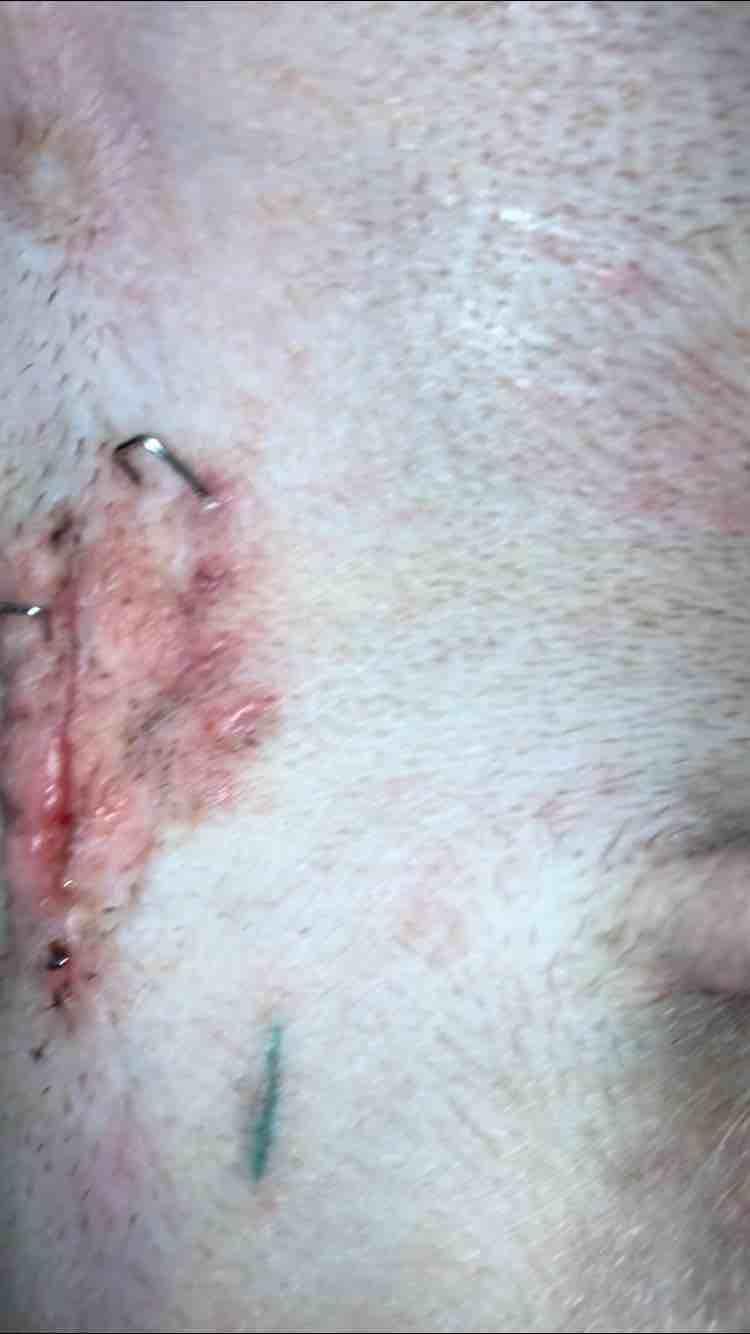 My dog pulled out spay staples after surgery. Is it an emergency? | Petco