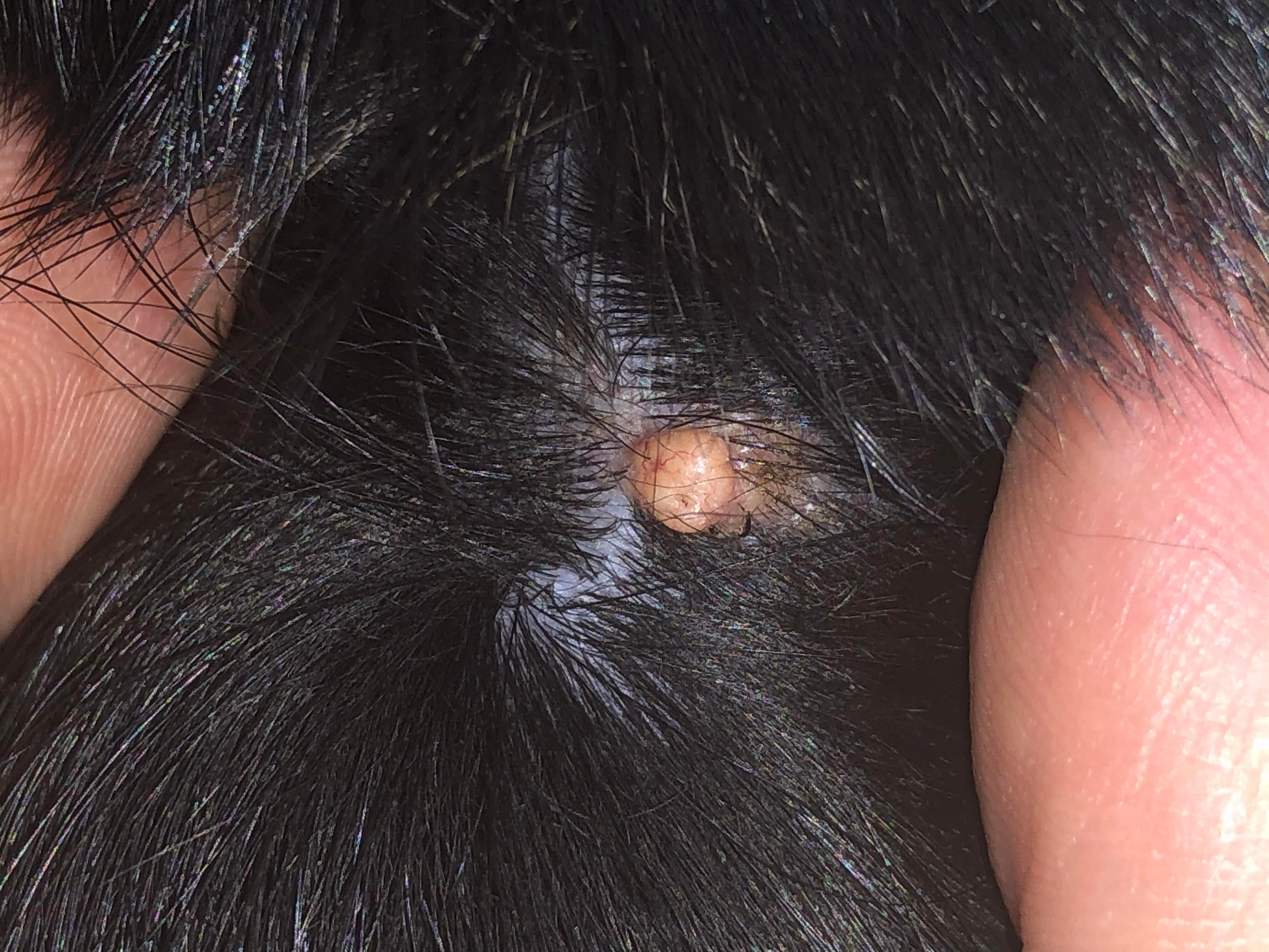My Dog Has a Painless Pimple-Like Bump on His Back? What Is It? | Petco