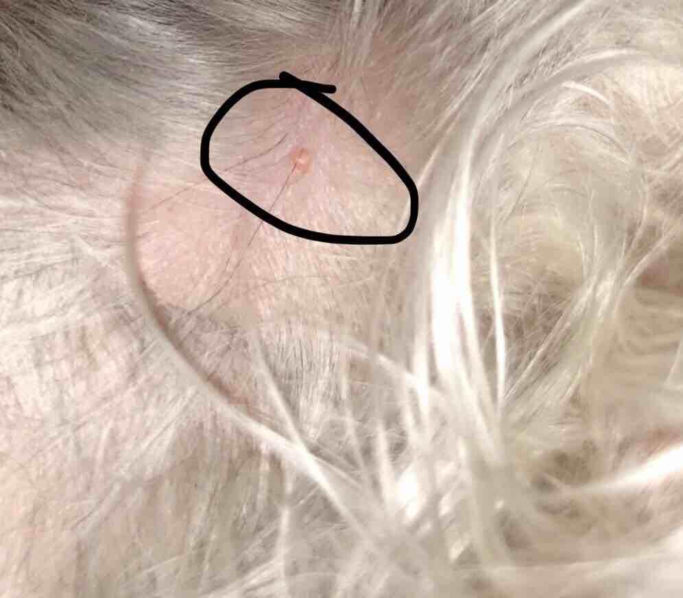 My Dog Has Dry, Flaky Skin & A Neck Bump. What Is It? | Petco