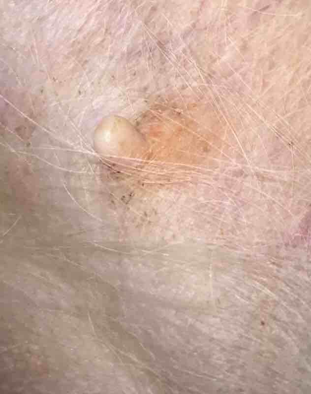 Why does my dog have a vulva bump & breast redness after Benadryl? | Petco