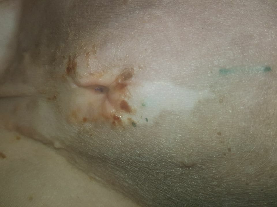 Puppy Spay Incision Looks Open? Infected? When to Call Vet? | Petco