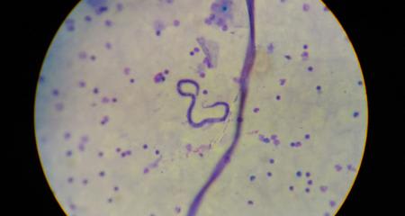 Can You Treat Heartworm Naturally?