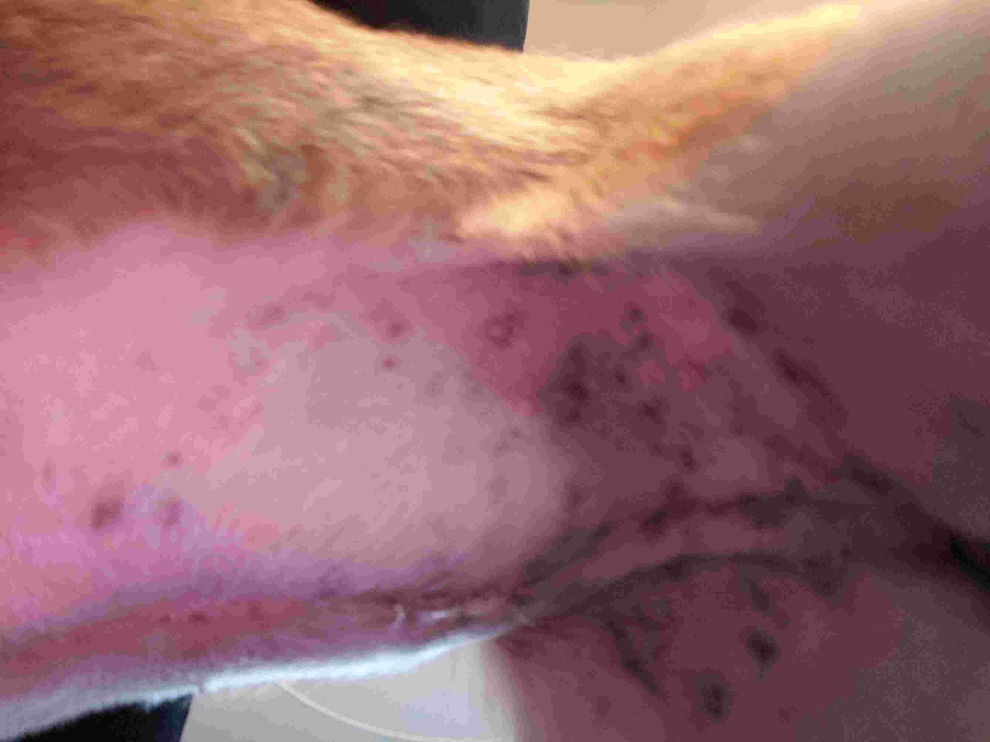 What are the signs of infection at your dog's spay incision site? | Petco