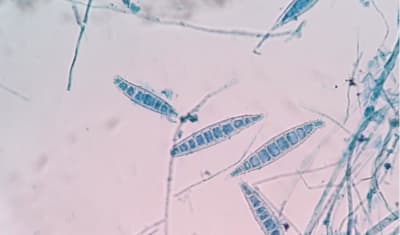 Dog Ringworm: Symptoms, Diagnosis, and Fungal Infection Treatment