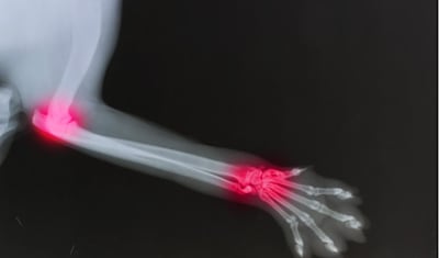 Rheumatoid Arthritis in Dogs: Symptoms, Diagnosis & Treatment