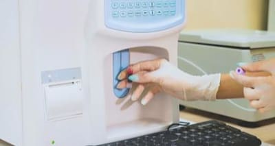 Pet Blood Work Explained: Understanding Chemistry Panel Results