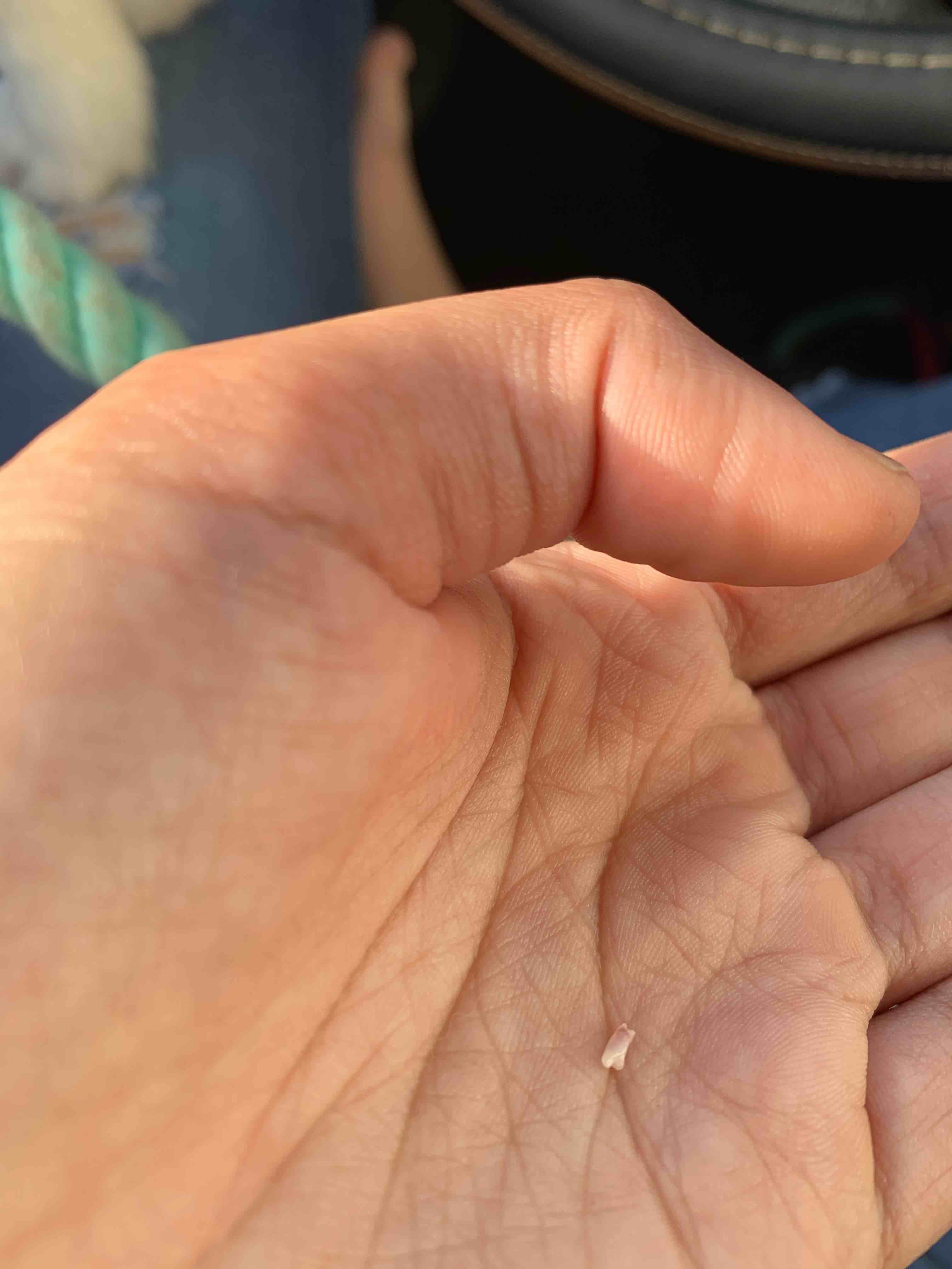 Question details sensitive content