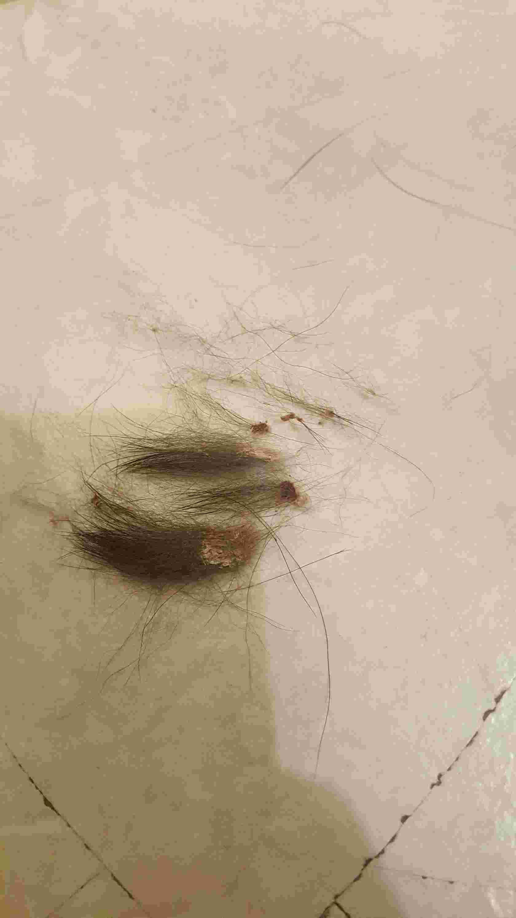 Question details sensitive content