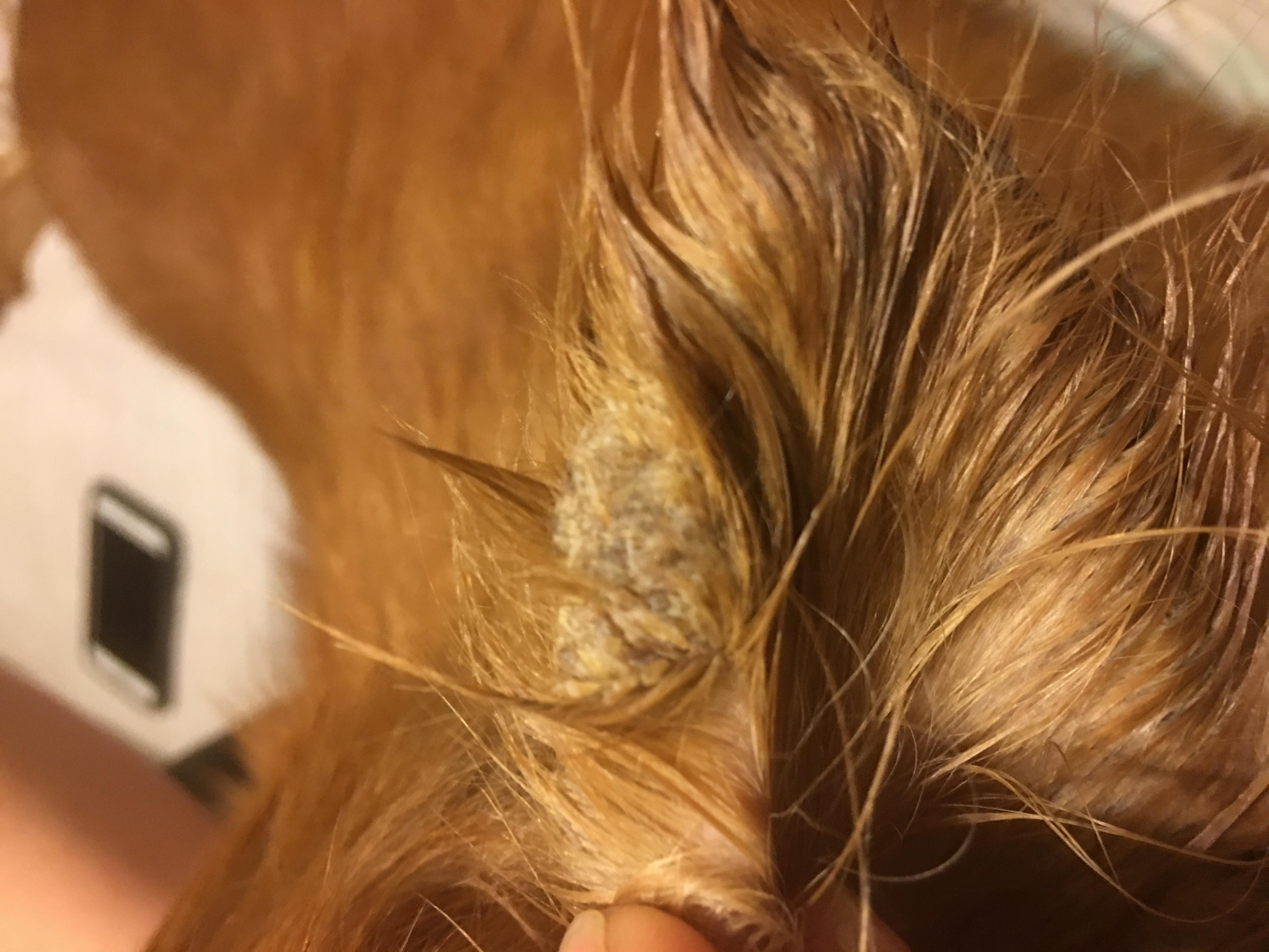 Question details sensitive content