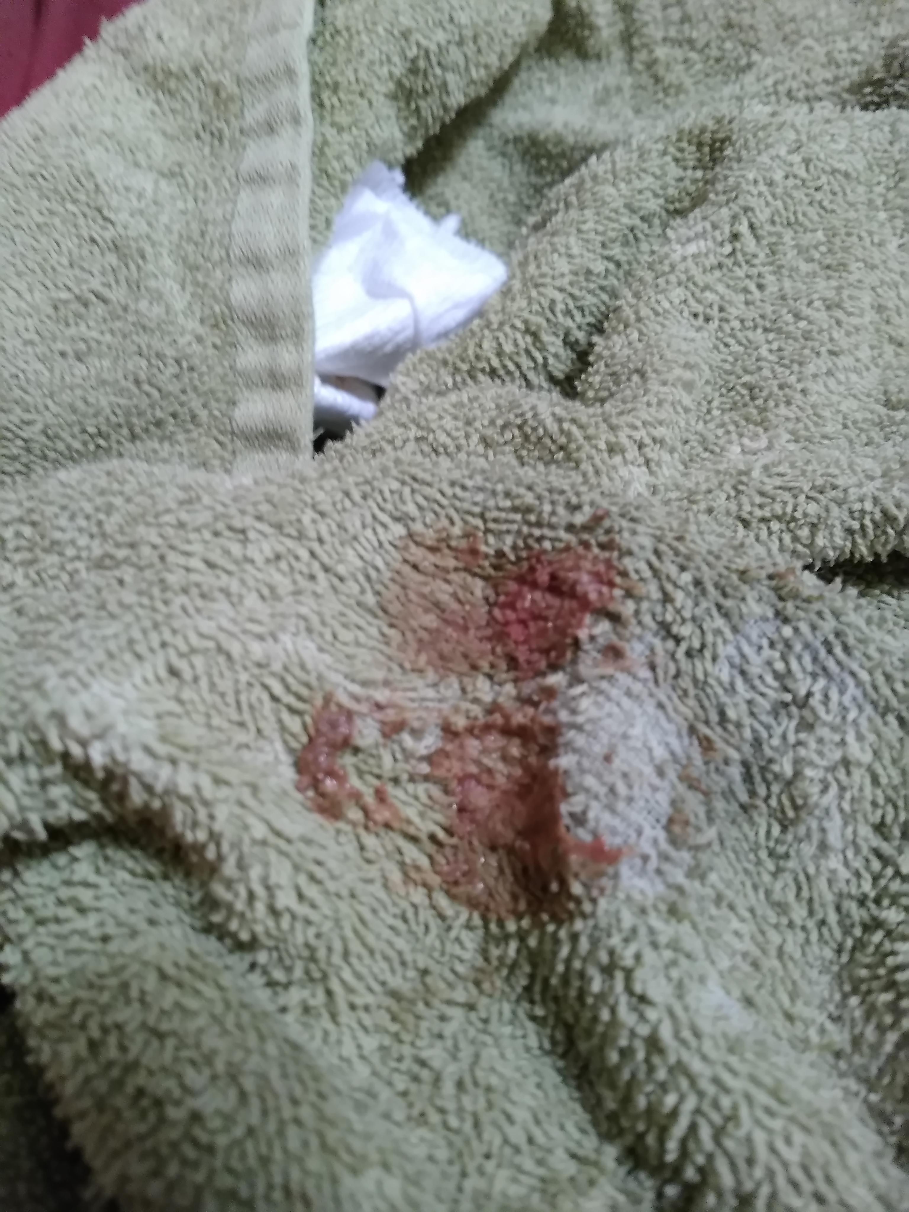 Question details sensitive content