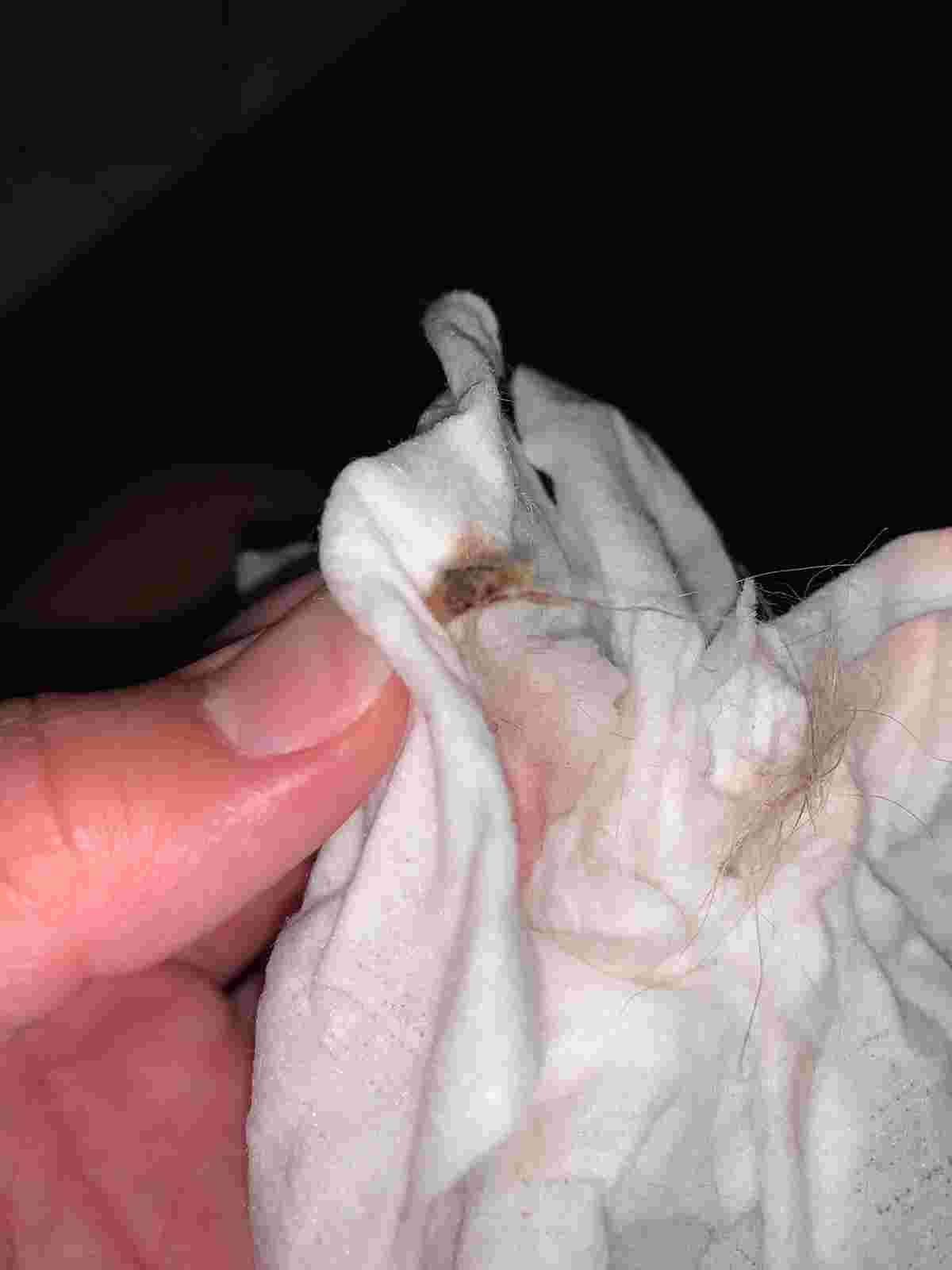 Question details sensitive content