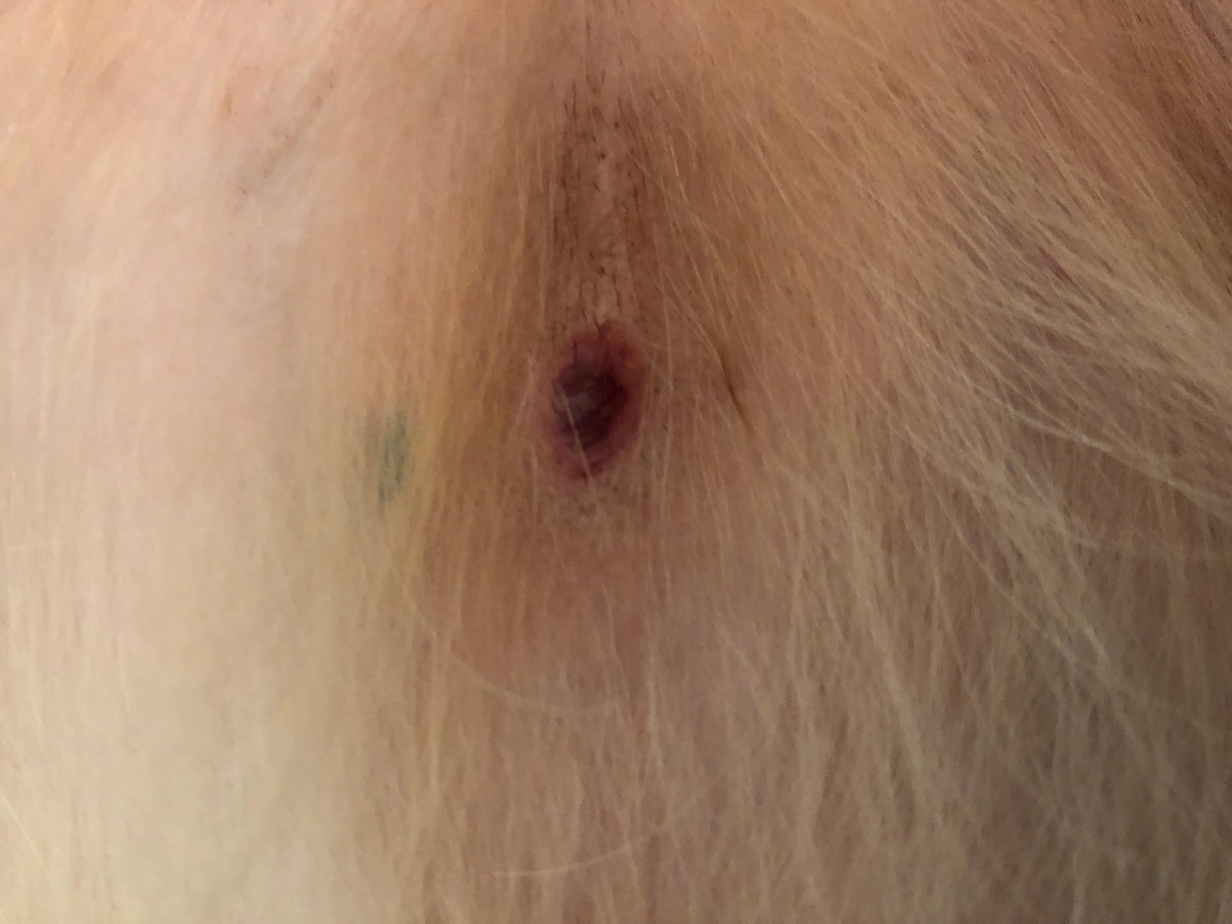 Question details sensitive content