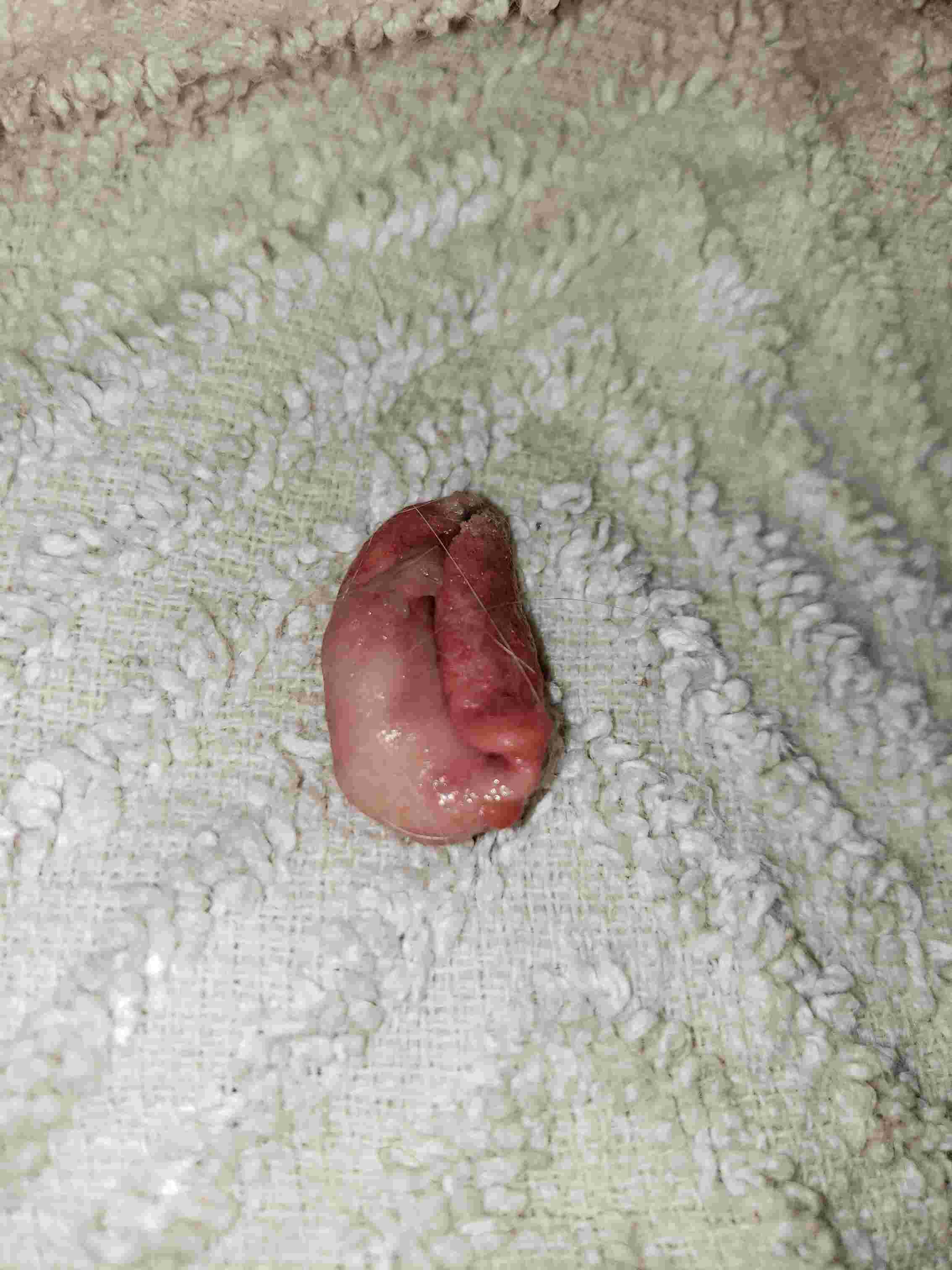 Question details sensitive content