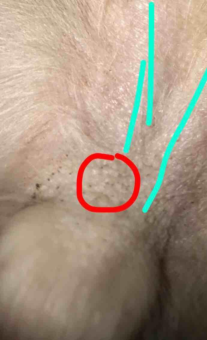 Question details sensitive content