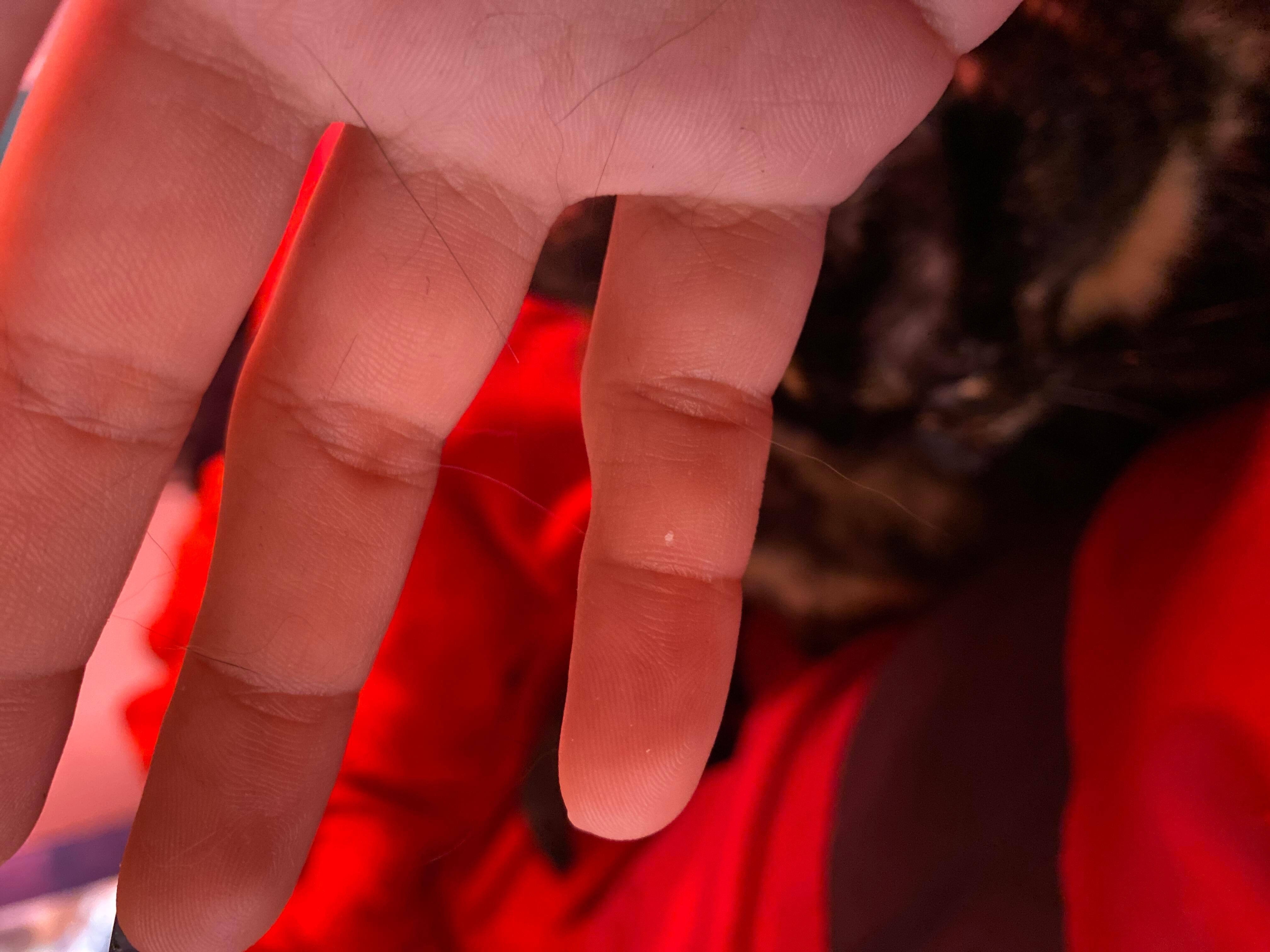 Question details sensitive content