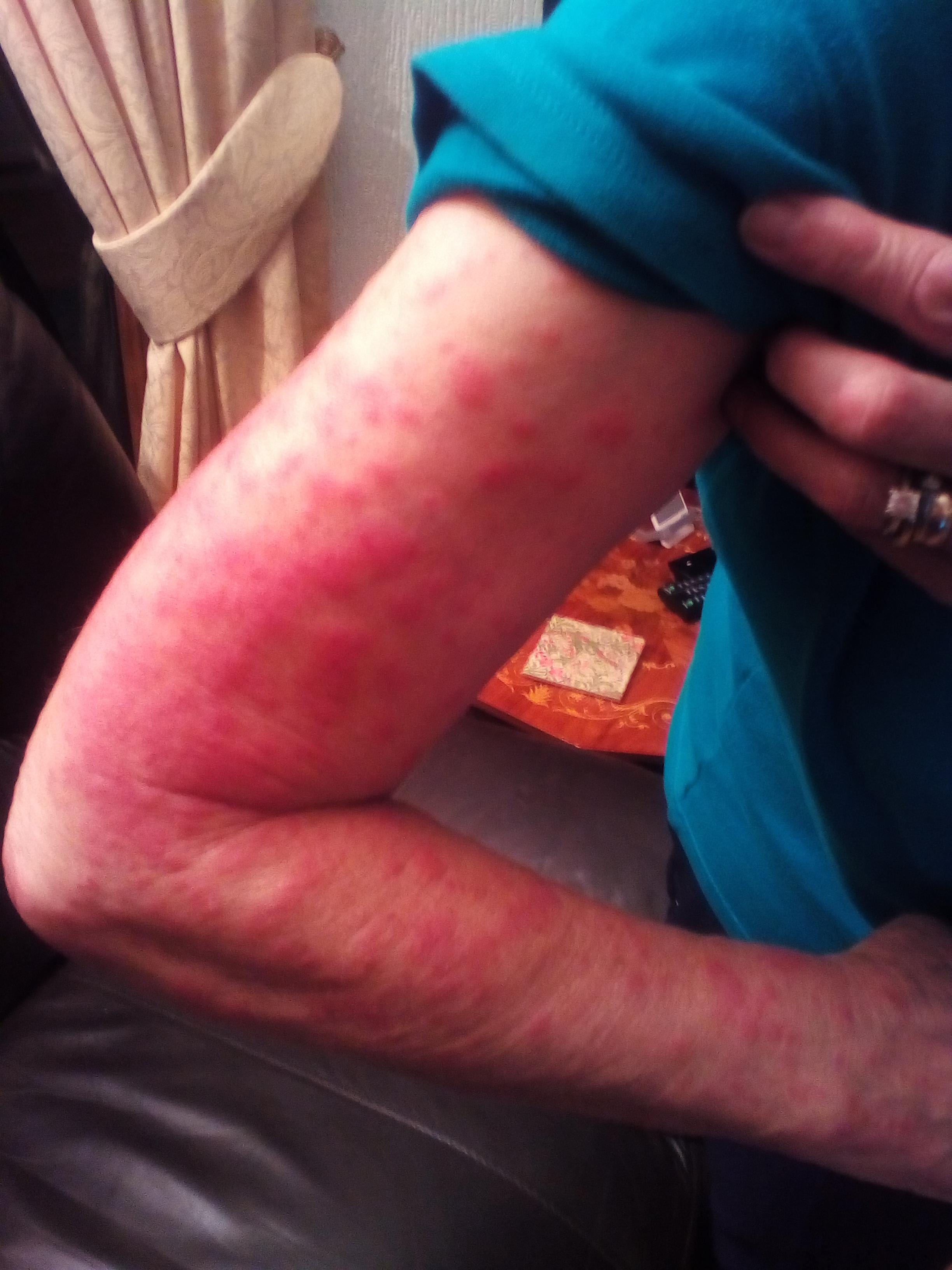 Question details sensitive content