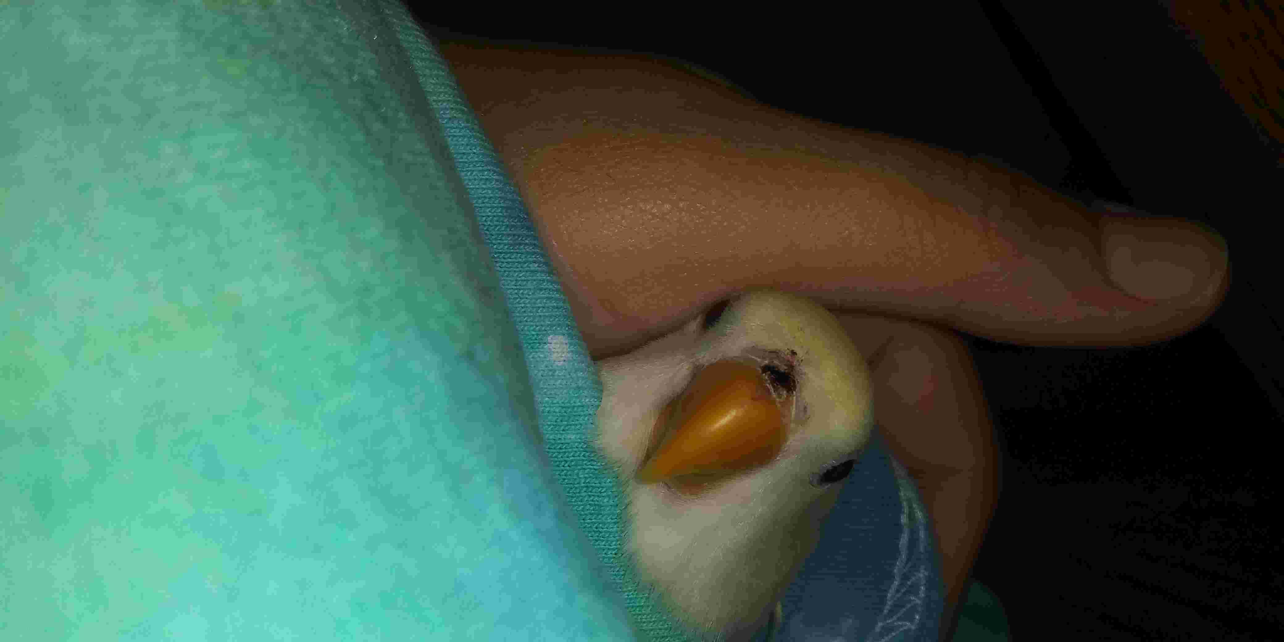 Question details sensitive content