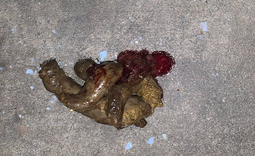 Question details sensitive content