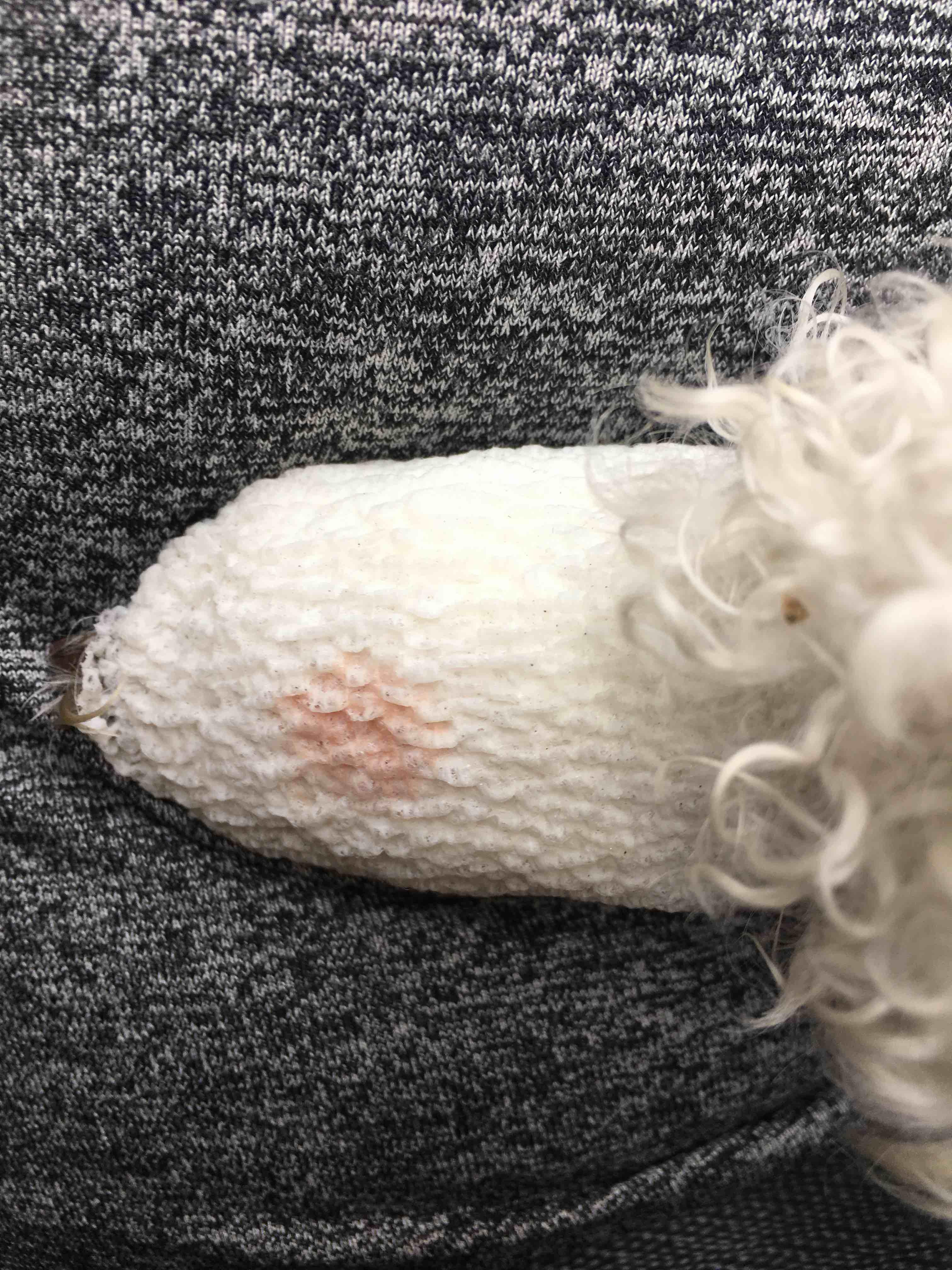 Question details sensitive content