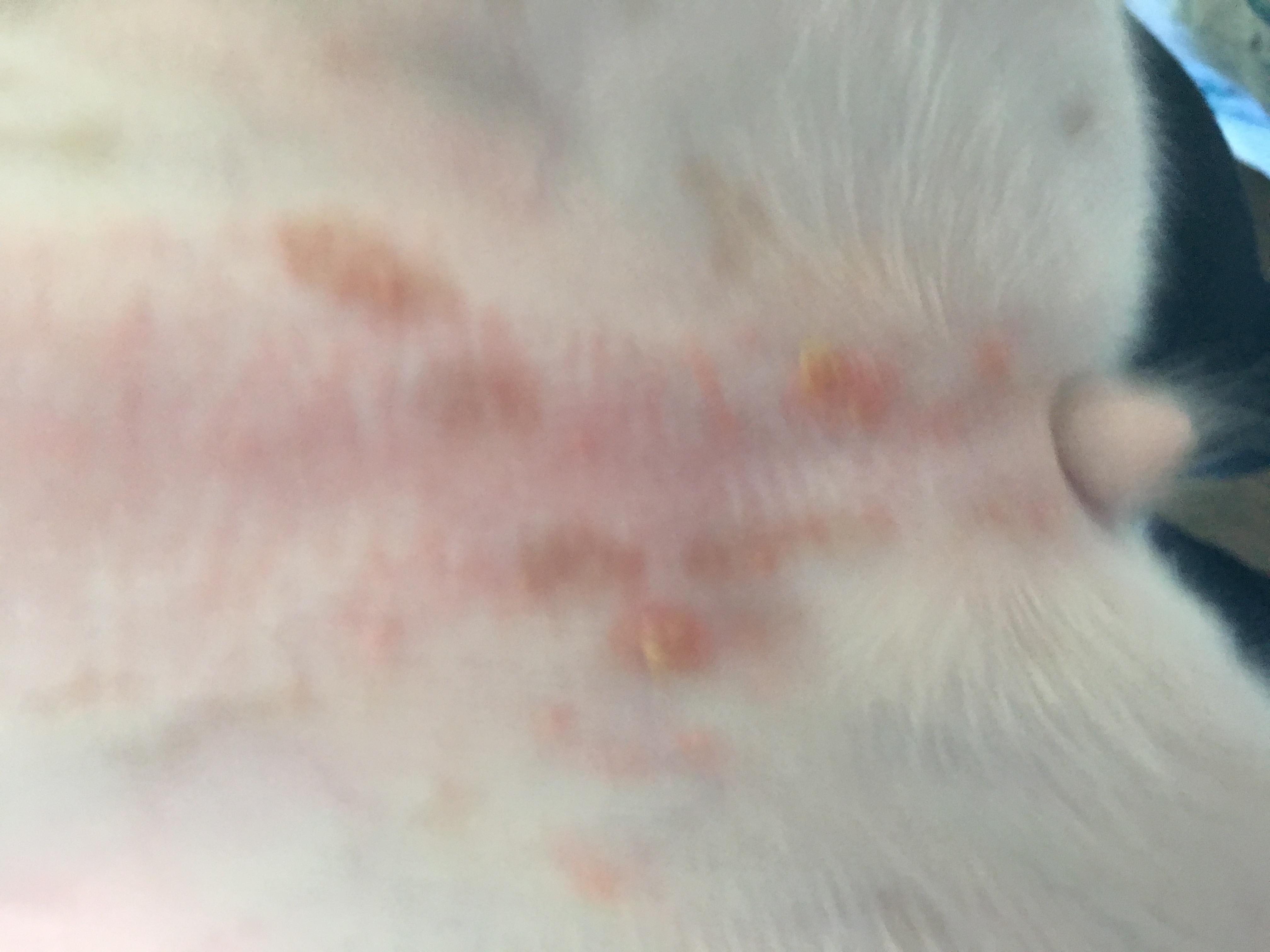 Question details sensitive content