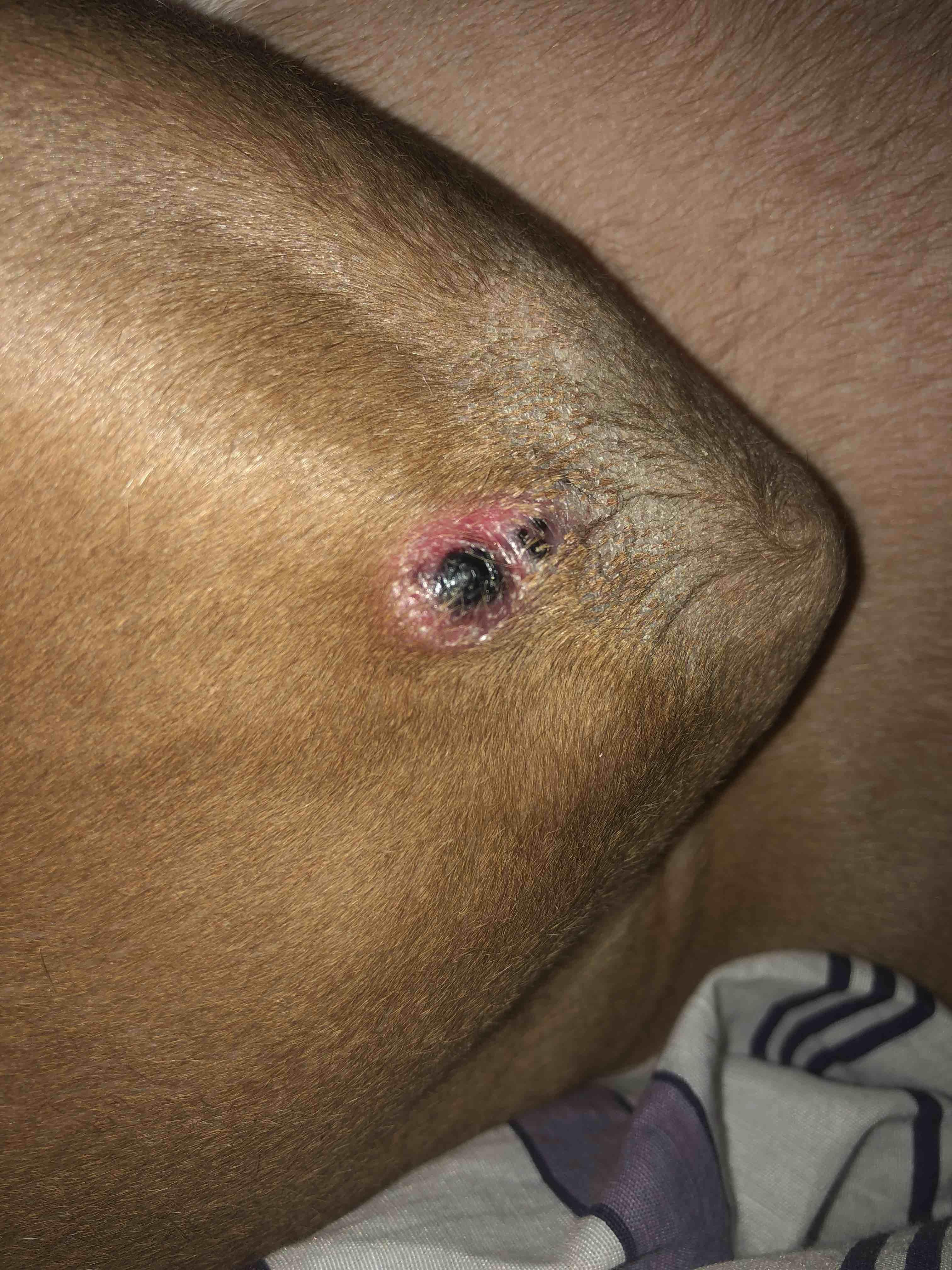 Question details sensitive content