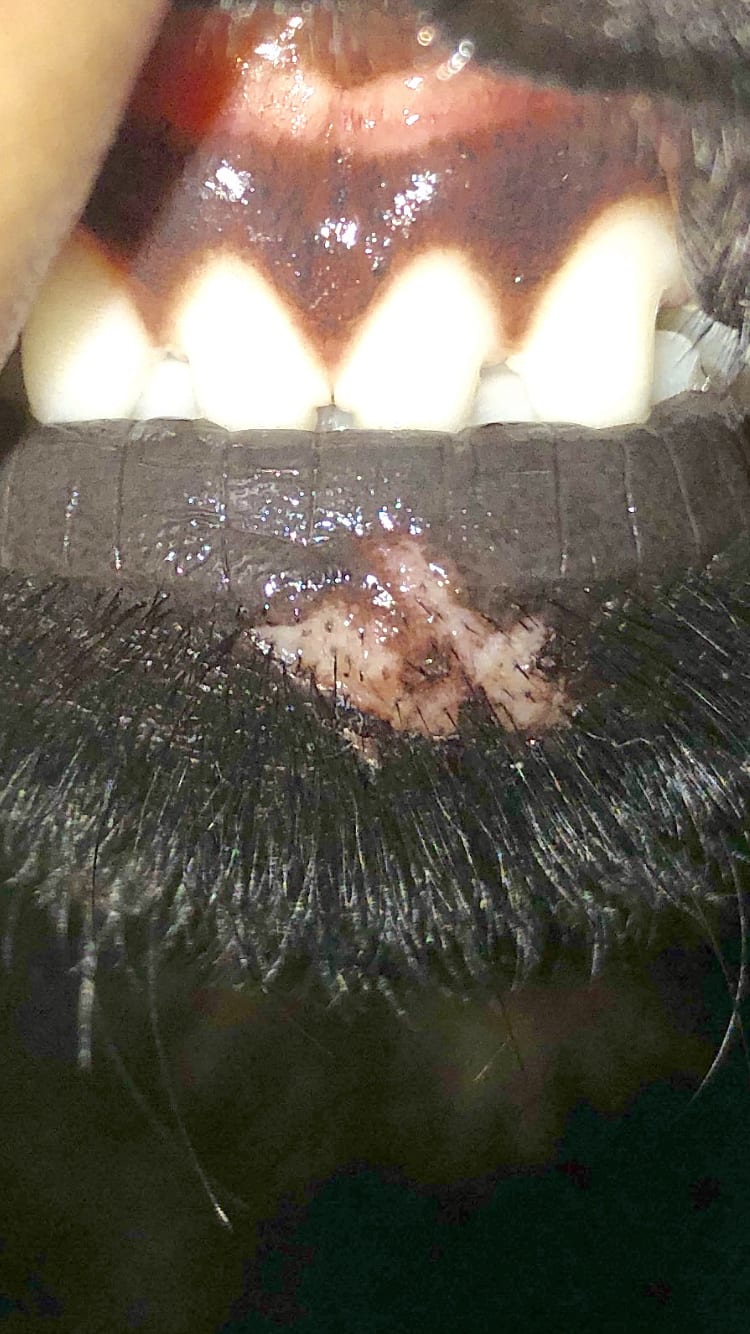 Question details sensitive content