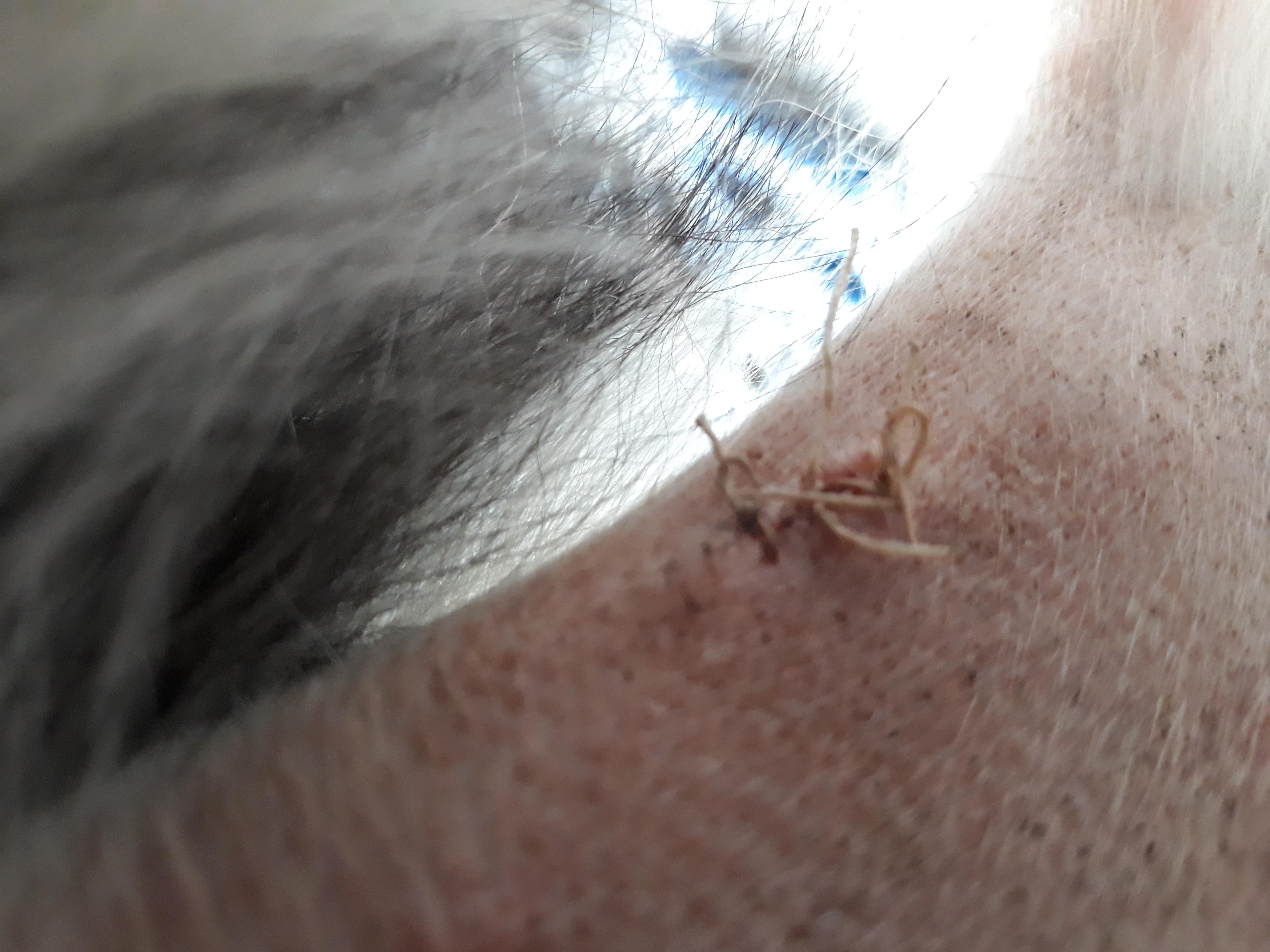 Question details sensitive content