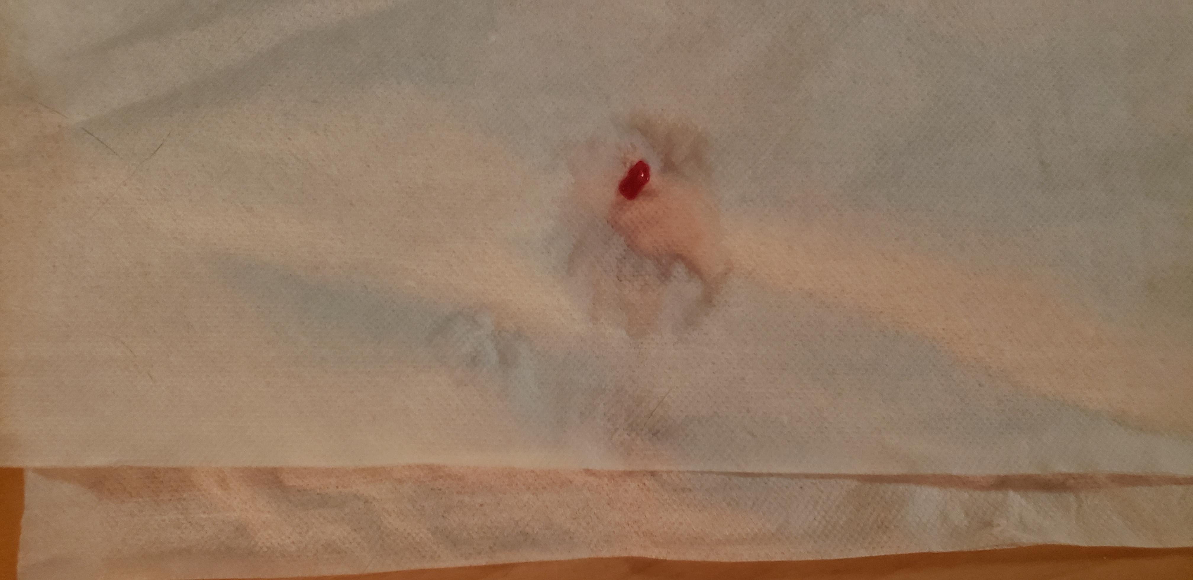 Question details sensitive content