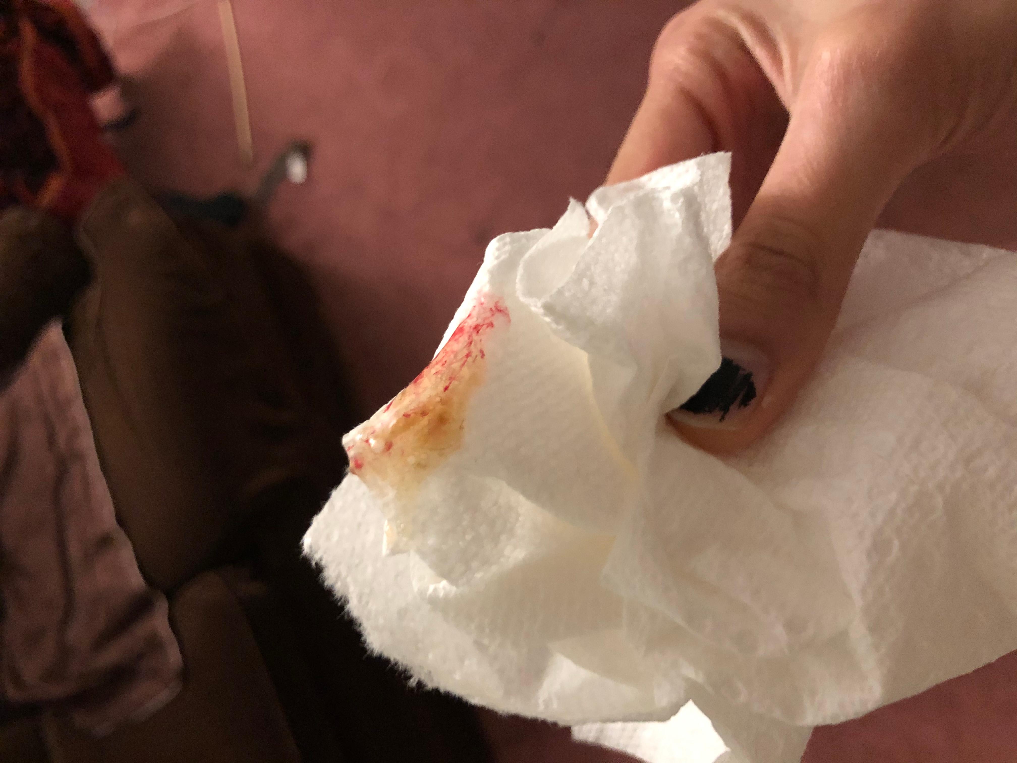 Question details sensitive content