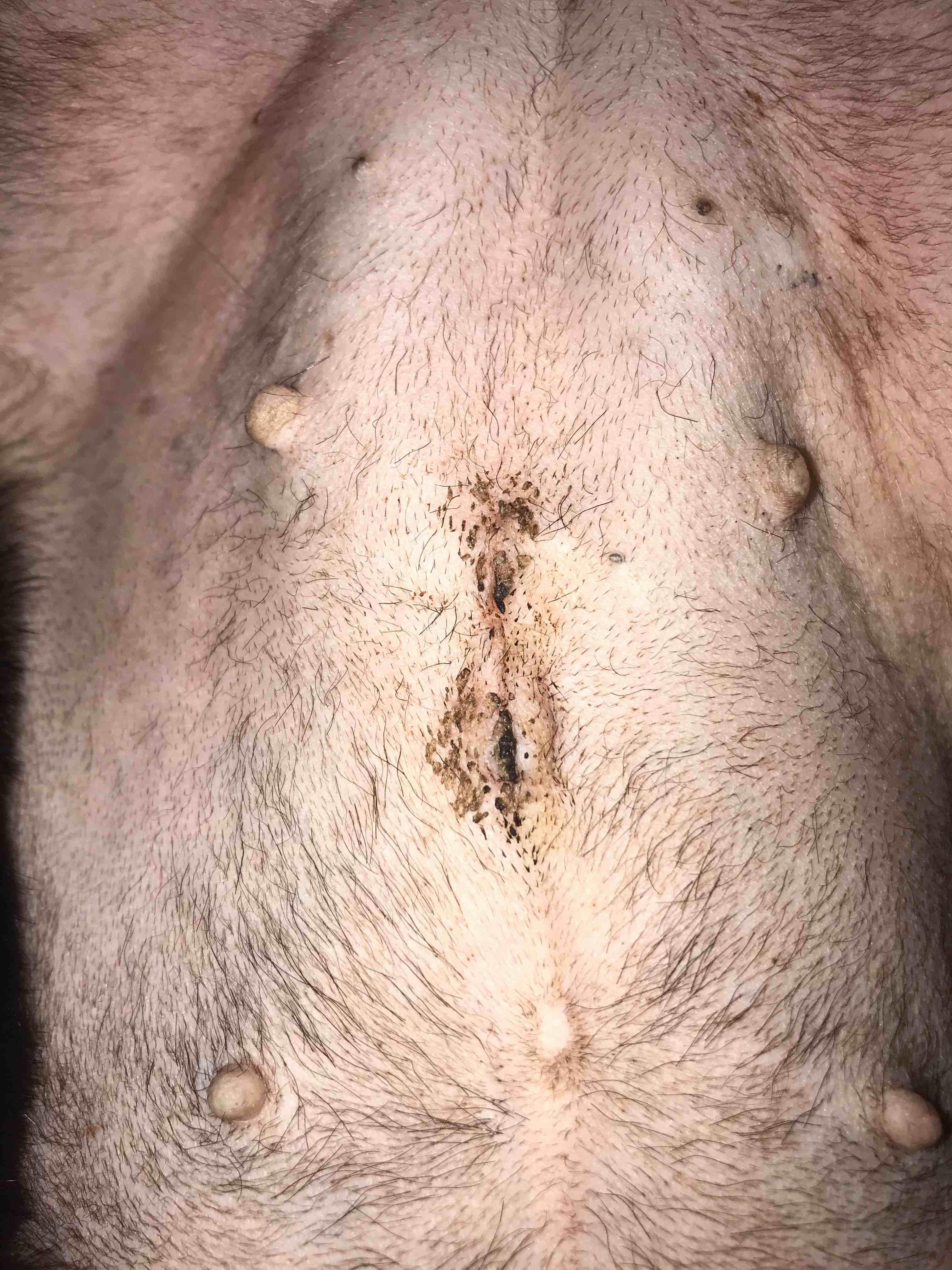 Question details sensitive content