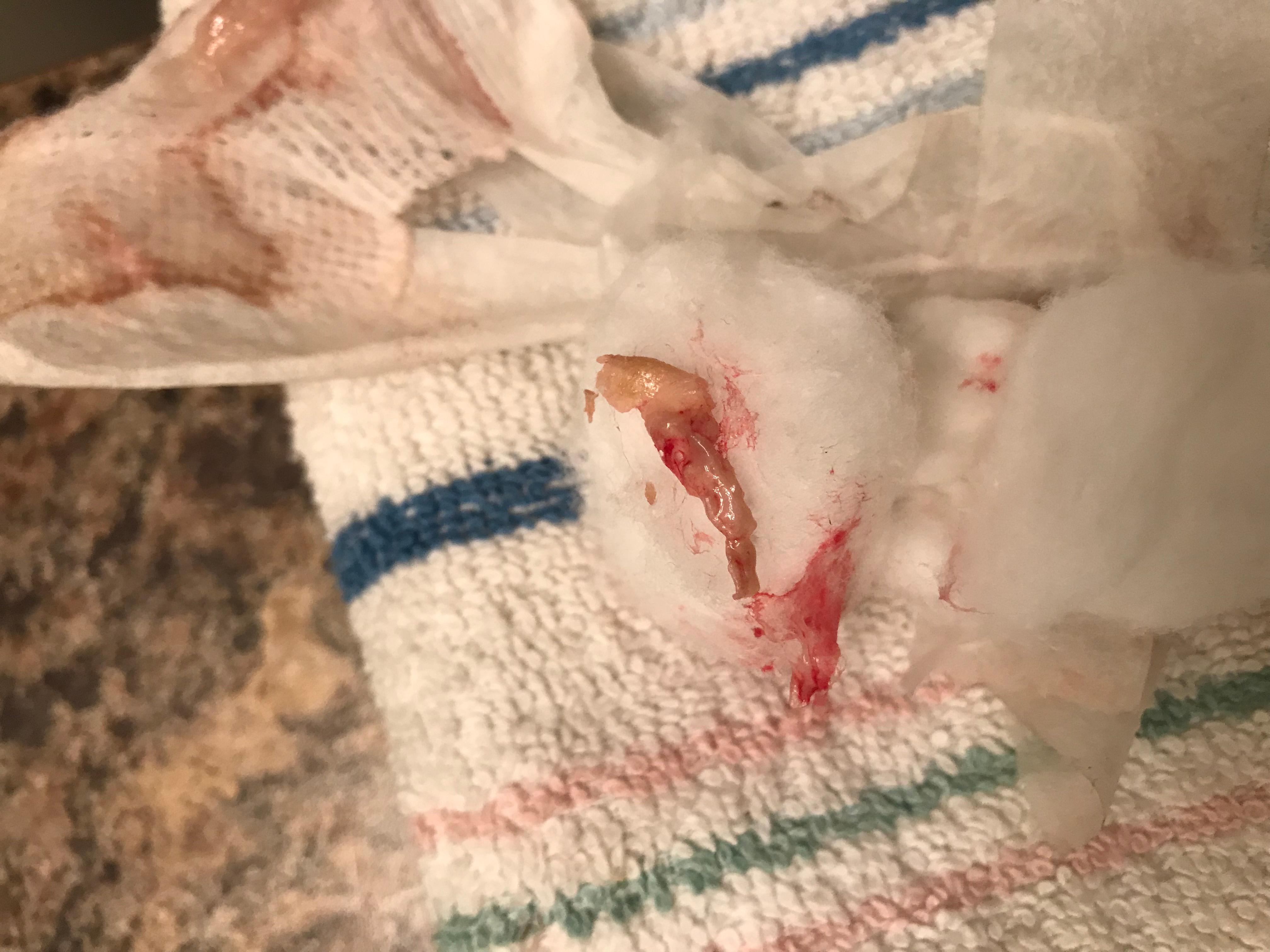 Question details sensitive content