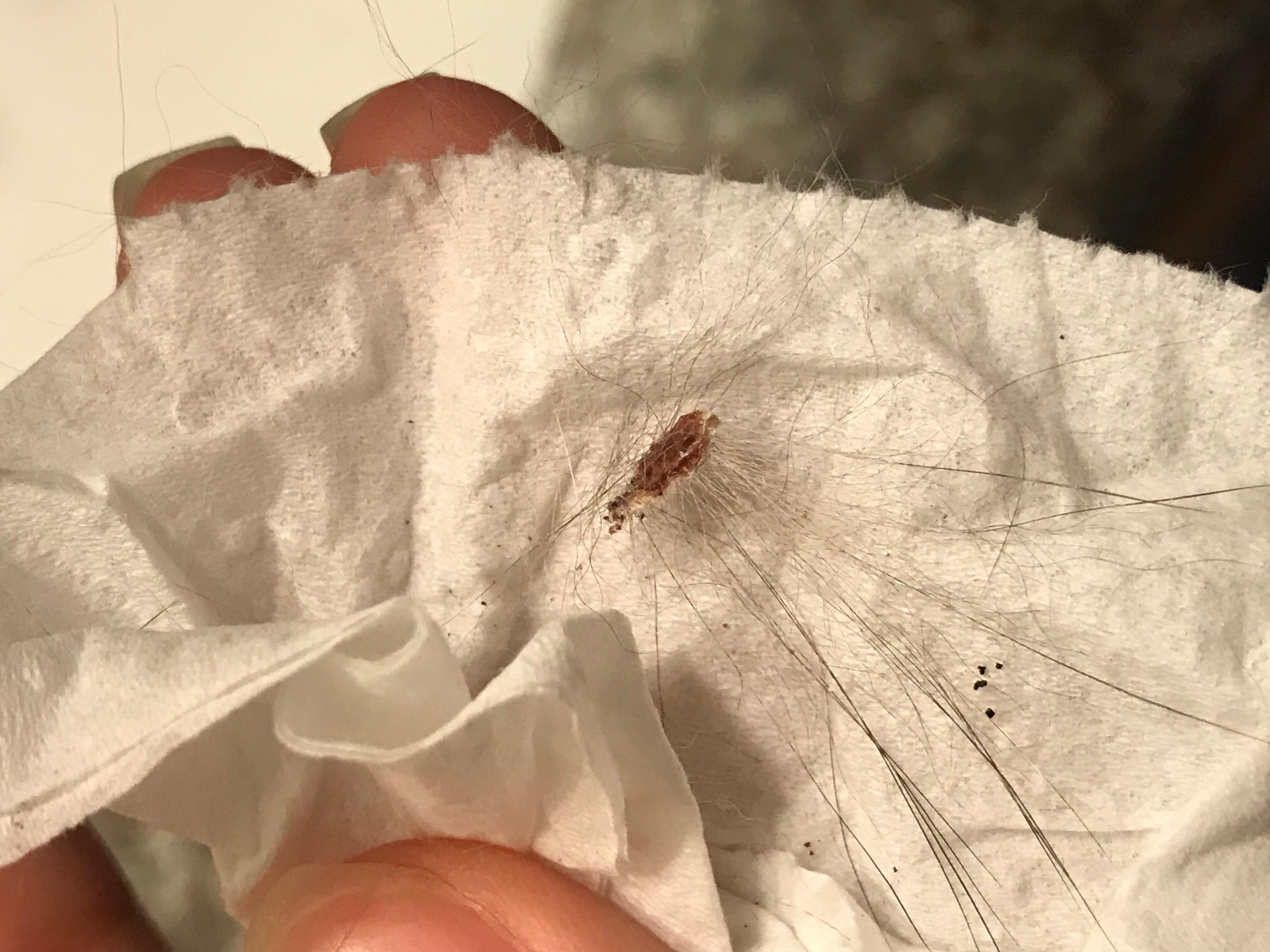 Question details sensitive content