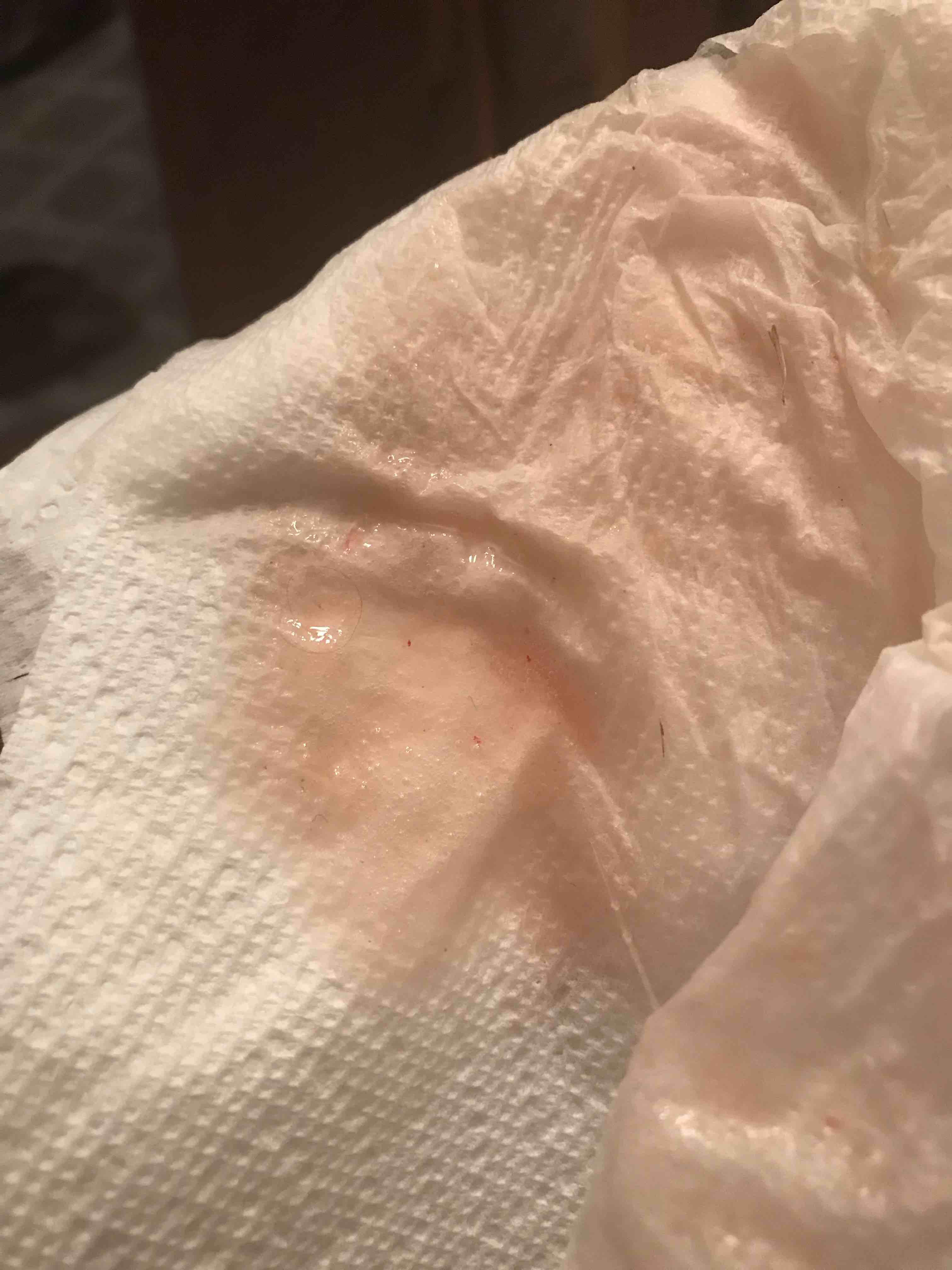 Question details sensitive content