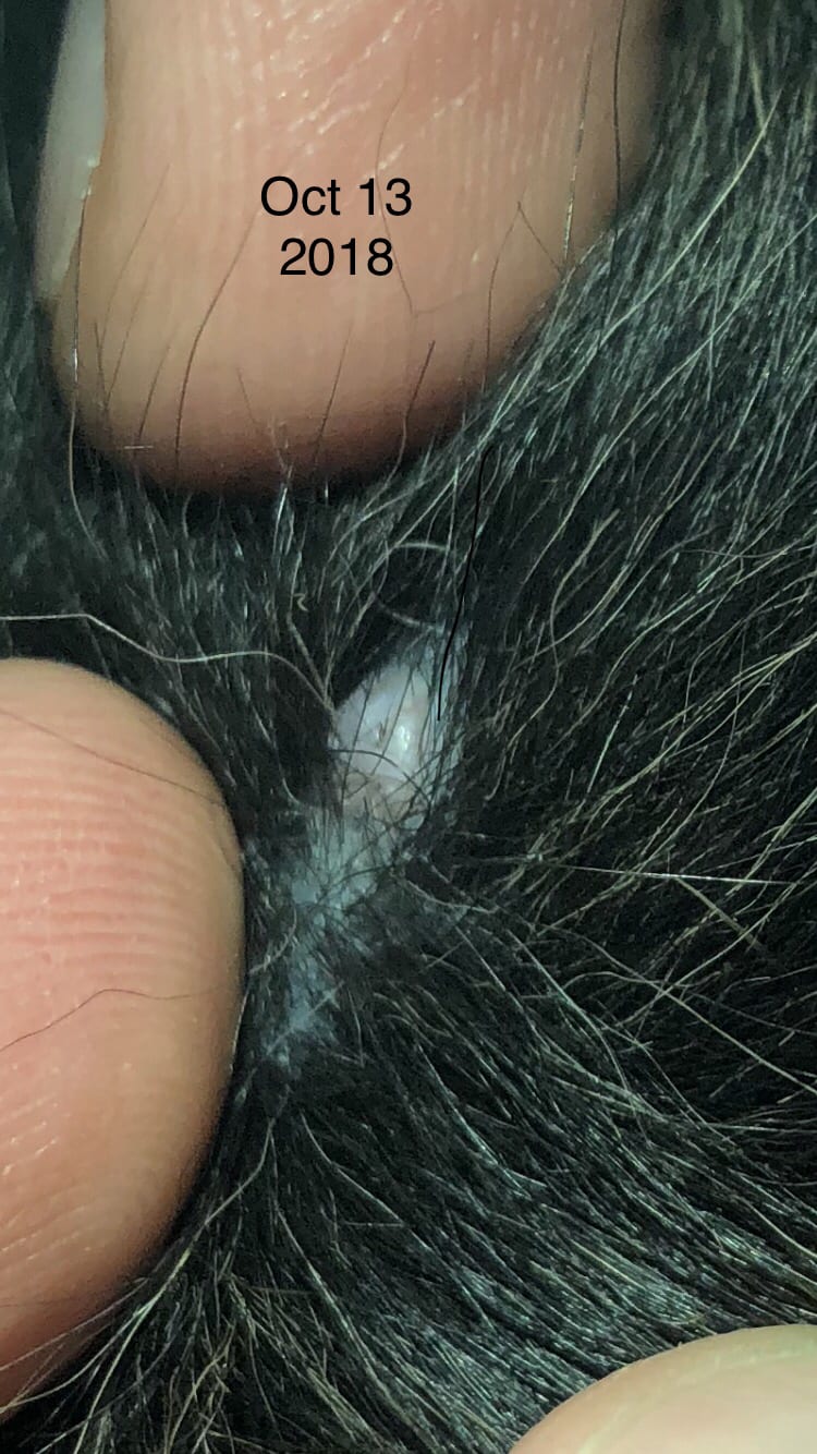 Question details sensitive content