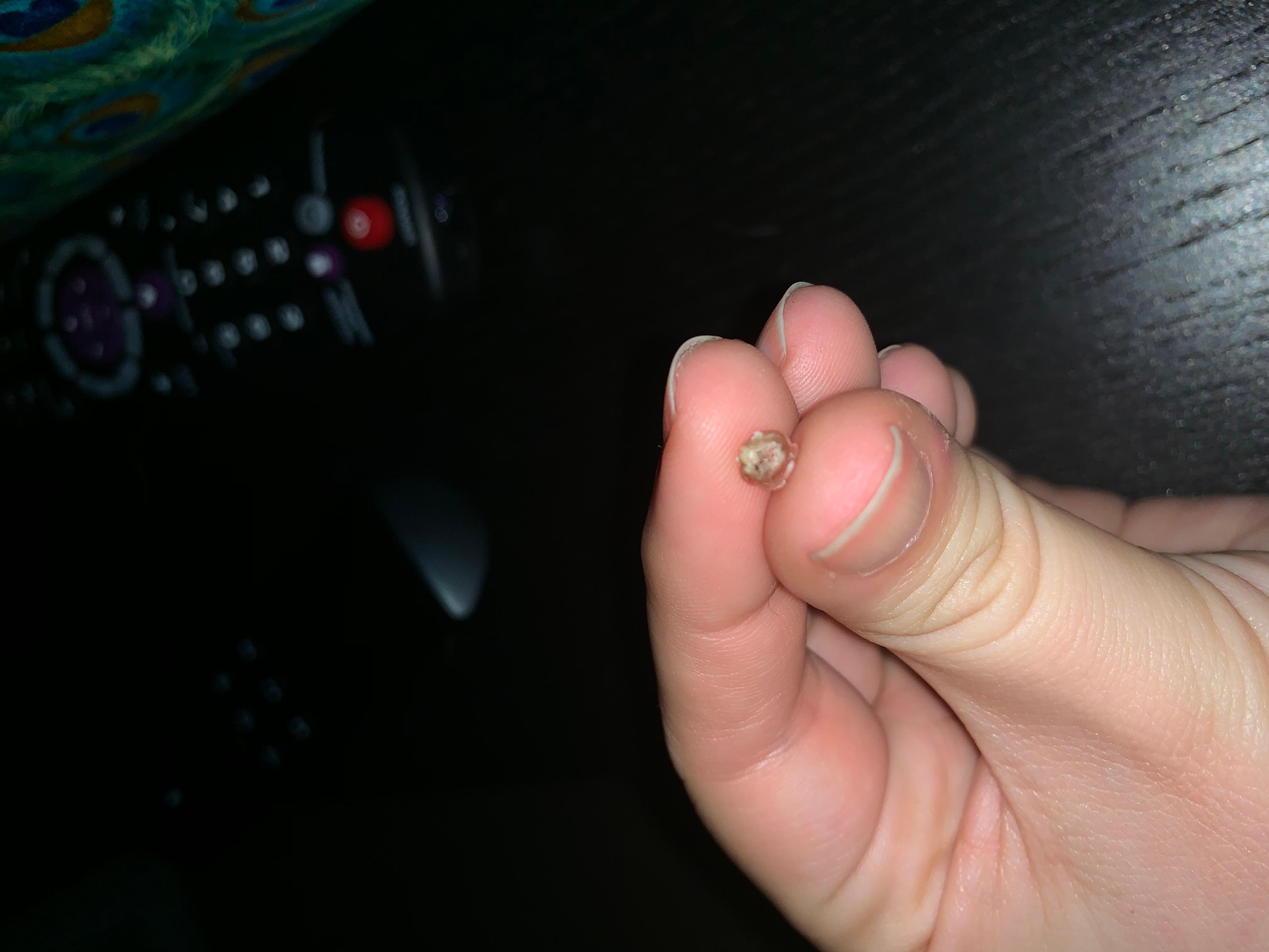 Question details sensitive content