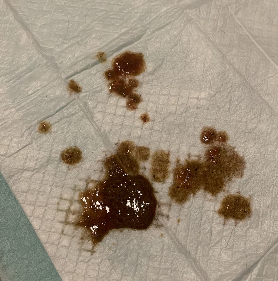 Question details sensitive content