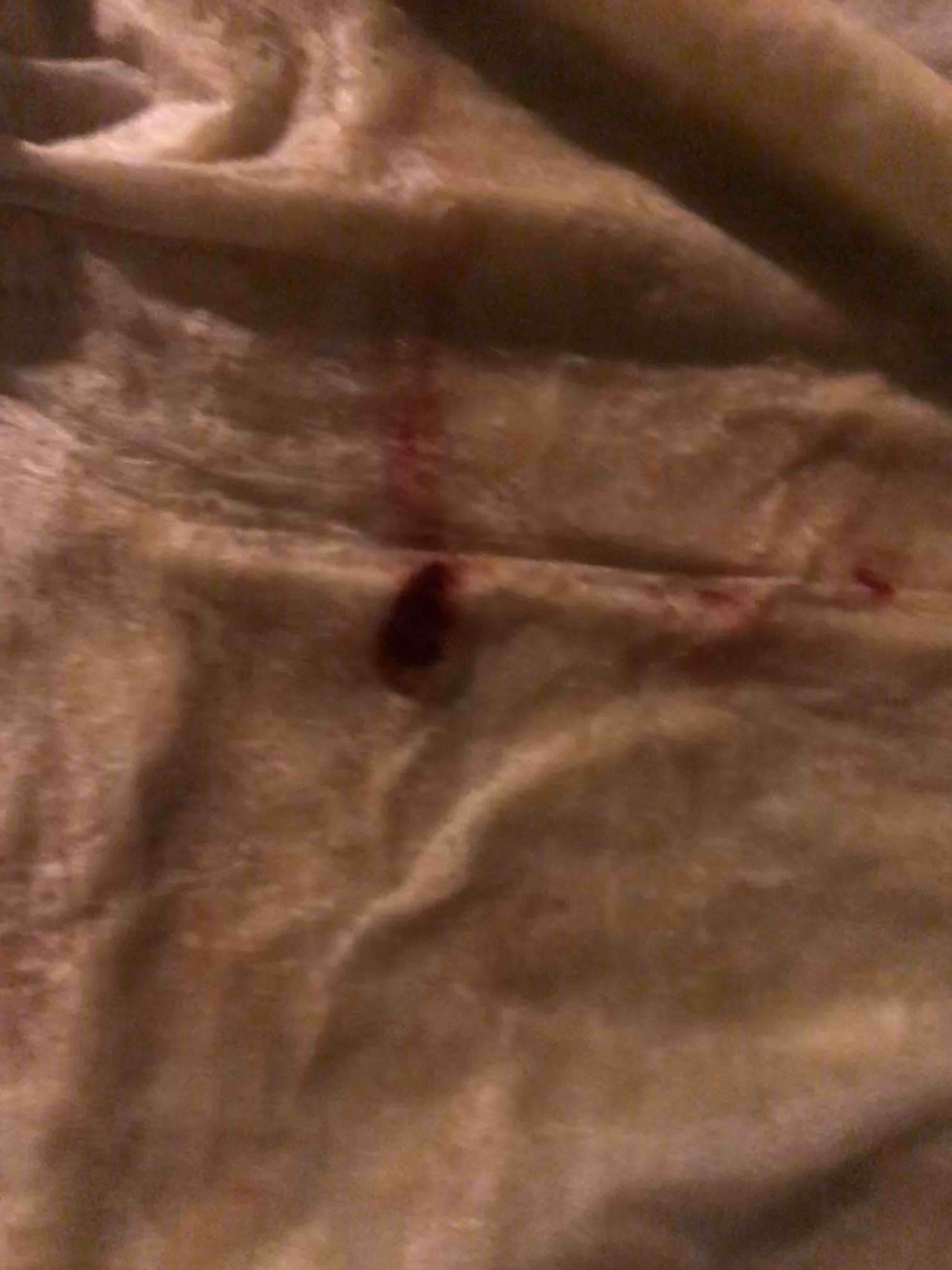 Question details sensitive content