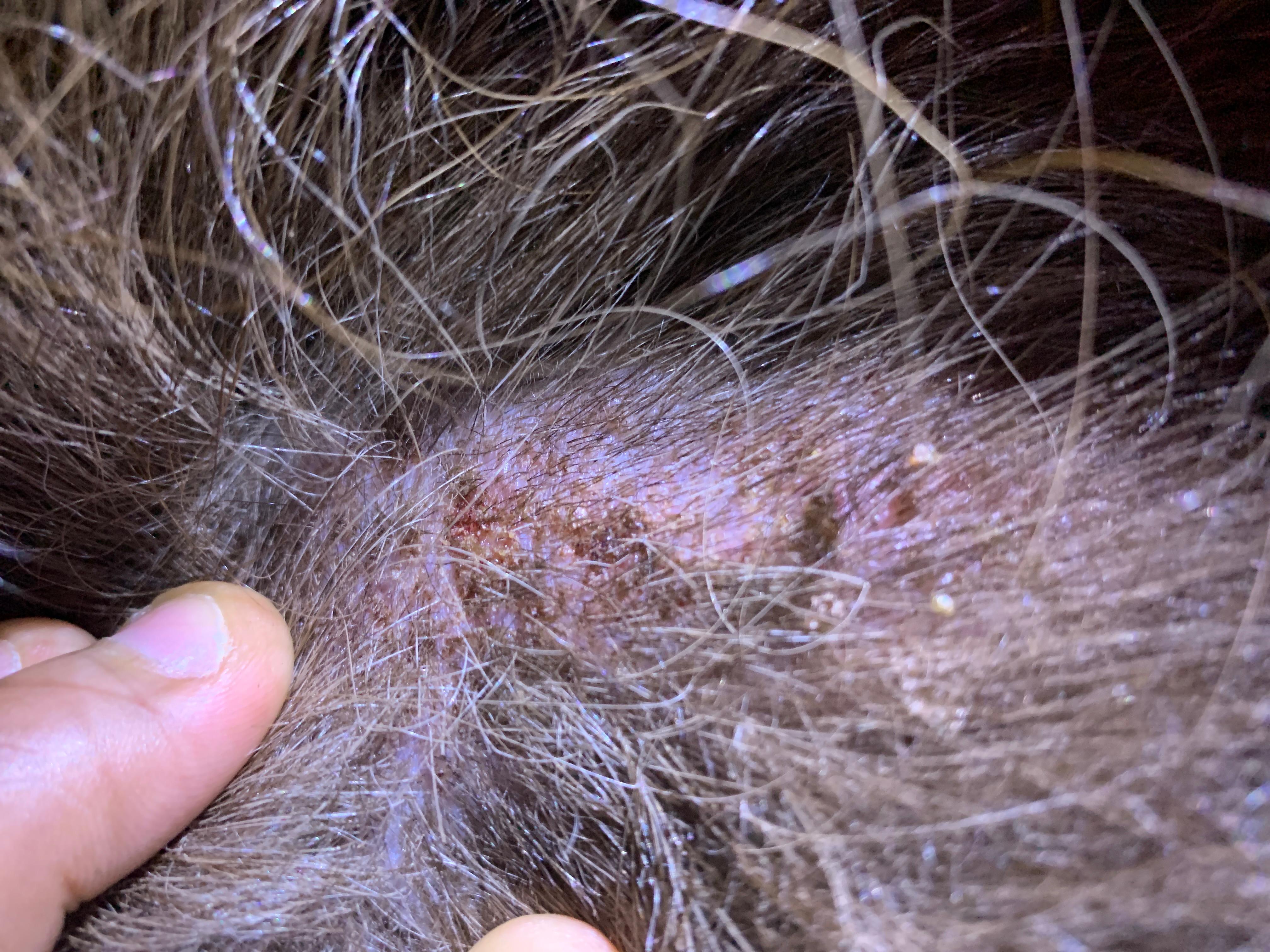 Question details sensitive content