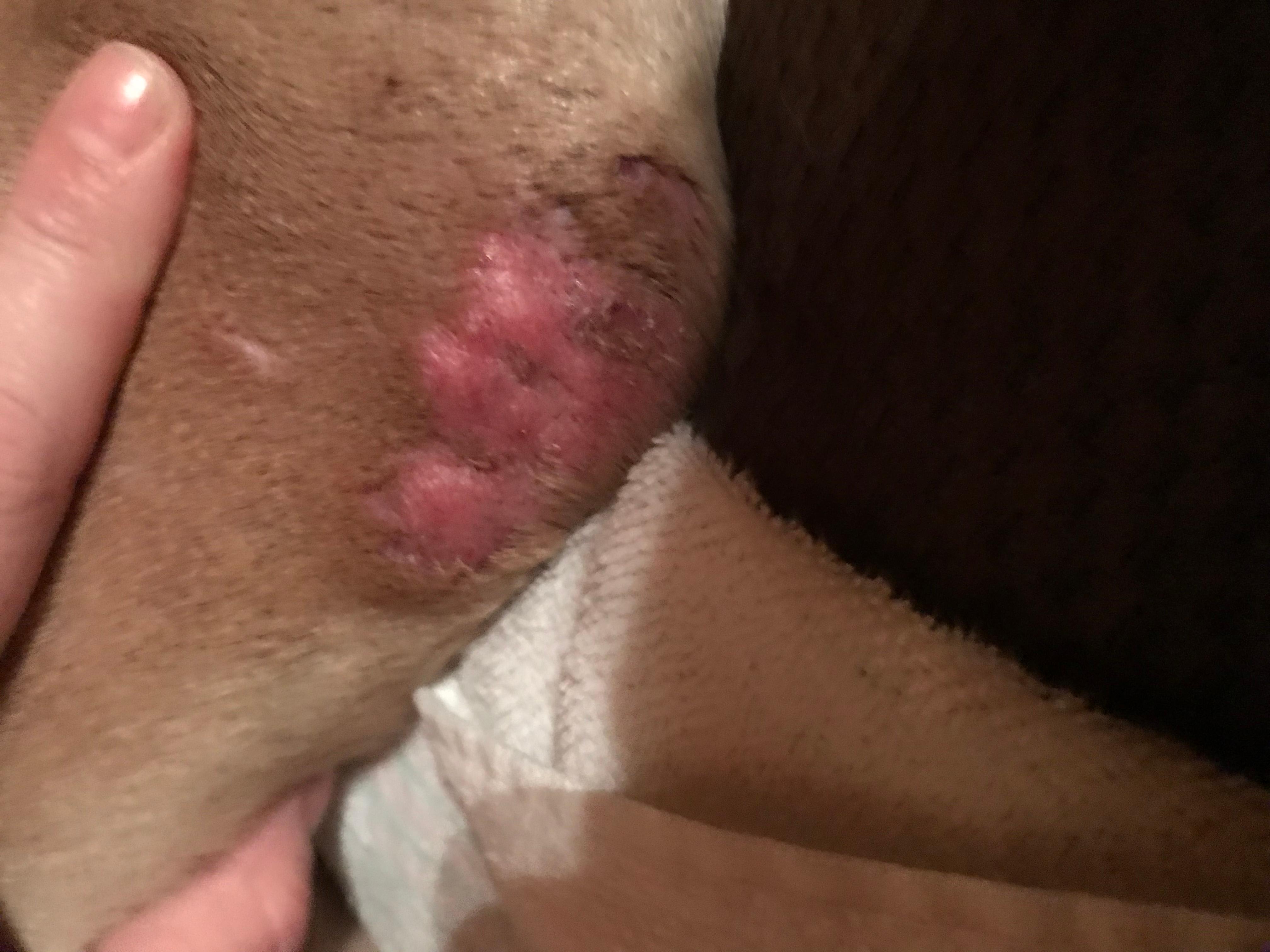 Question details sensitive content