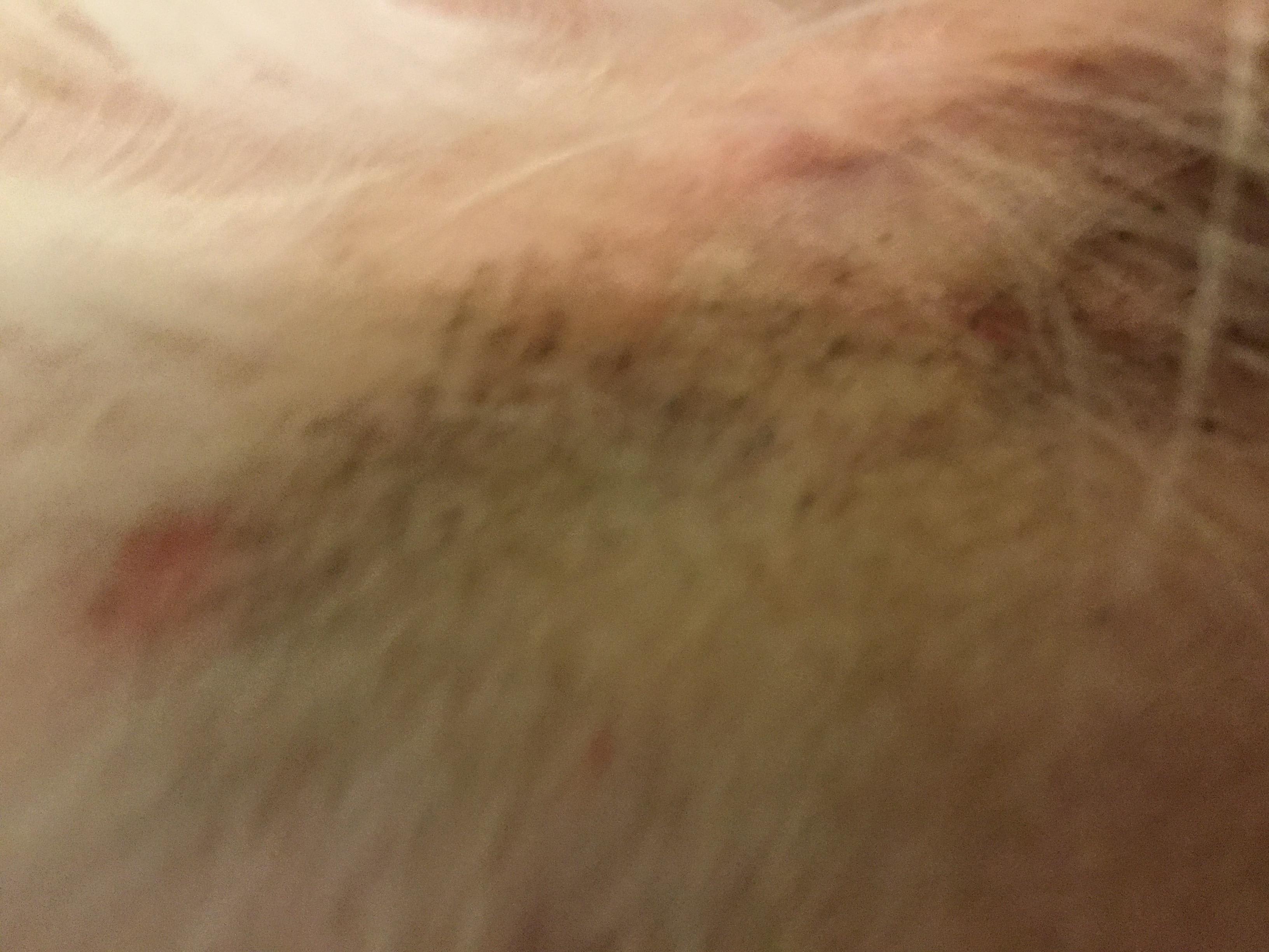 Question details sensitive content